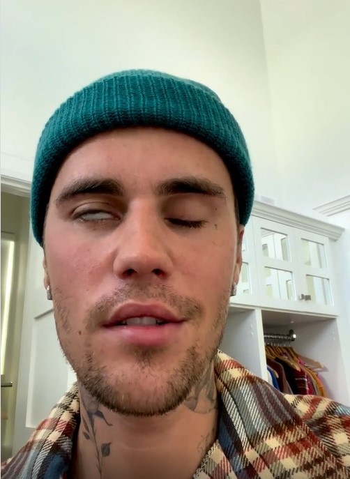 Justin Bieber revealed in a video he has recently been diagnosed with Ramsay Hunt syndrome. Photo / Instagram @justinbieber
