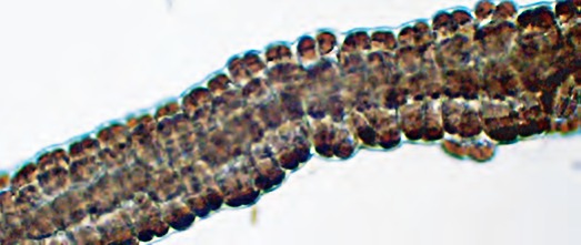 Eyelash seaweed. CREDIT: NIWA