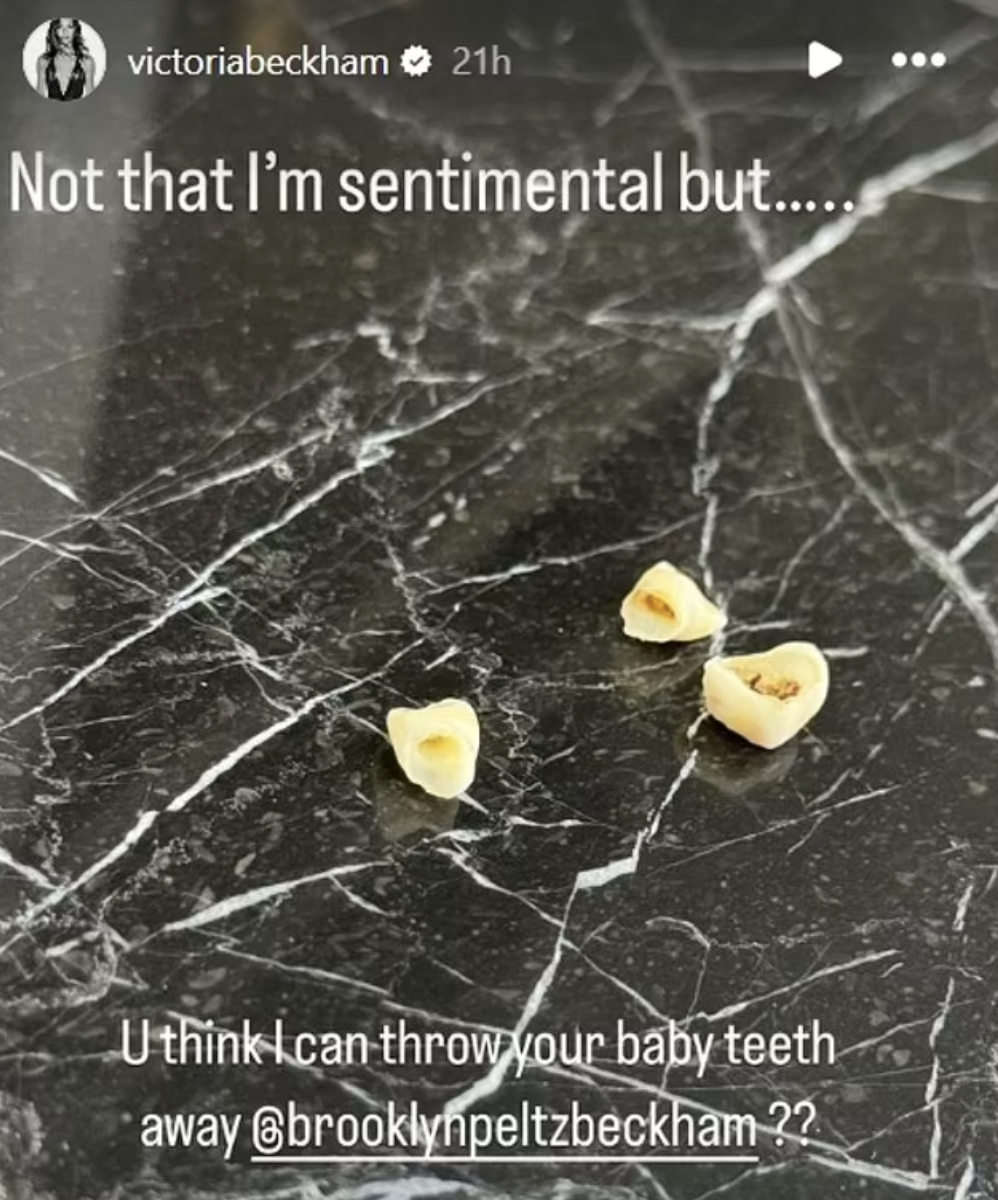 Victoria Beckham shared an image of her son's baby teeth. Photo / Instagram @victoriabeckham