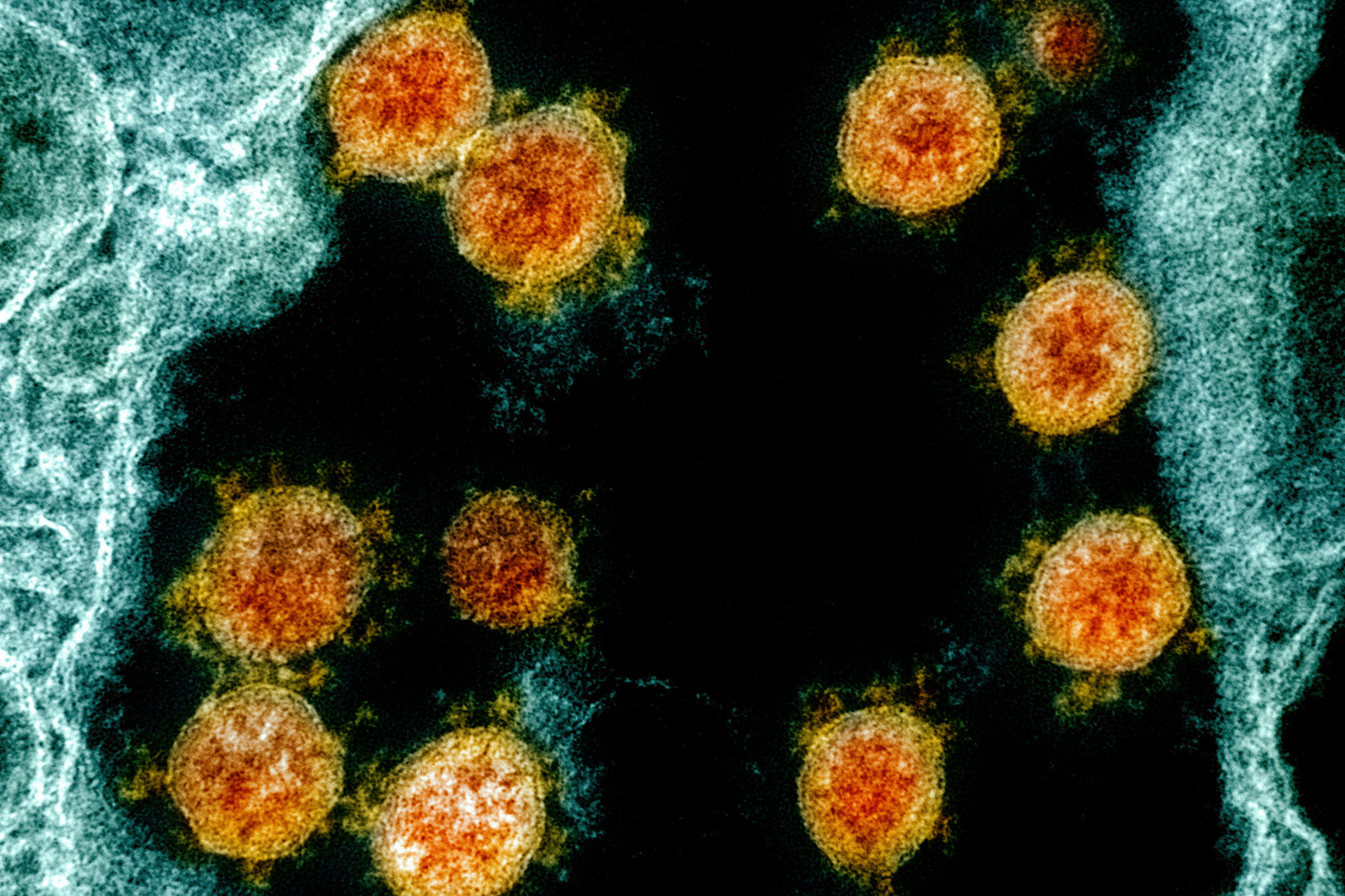 Covid-19 is a tricky virus and every time it emerges, there is a roll of the dice. Photo / AP