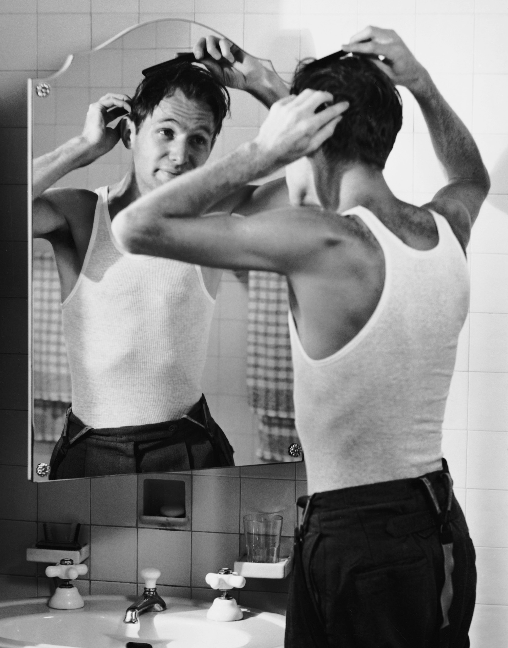 Hairline holidays are gaining traction with New Zealanders. Here's what it's really like to get a hair transplant, from someone who's just had one. Photo /Getty Images