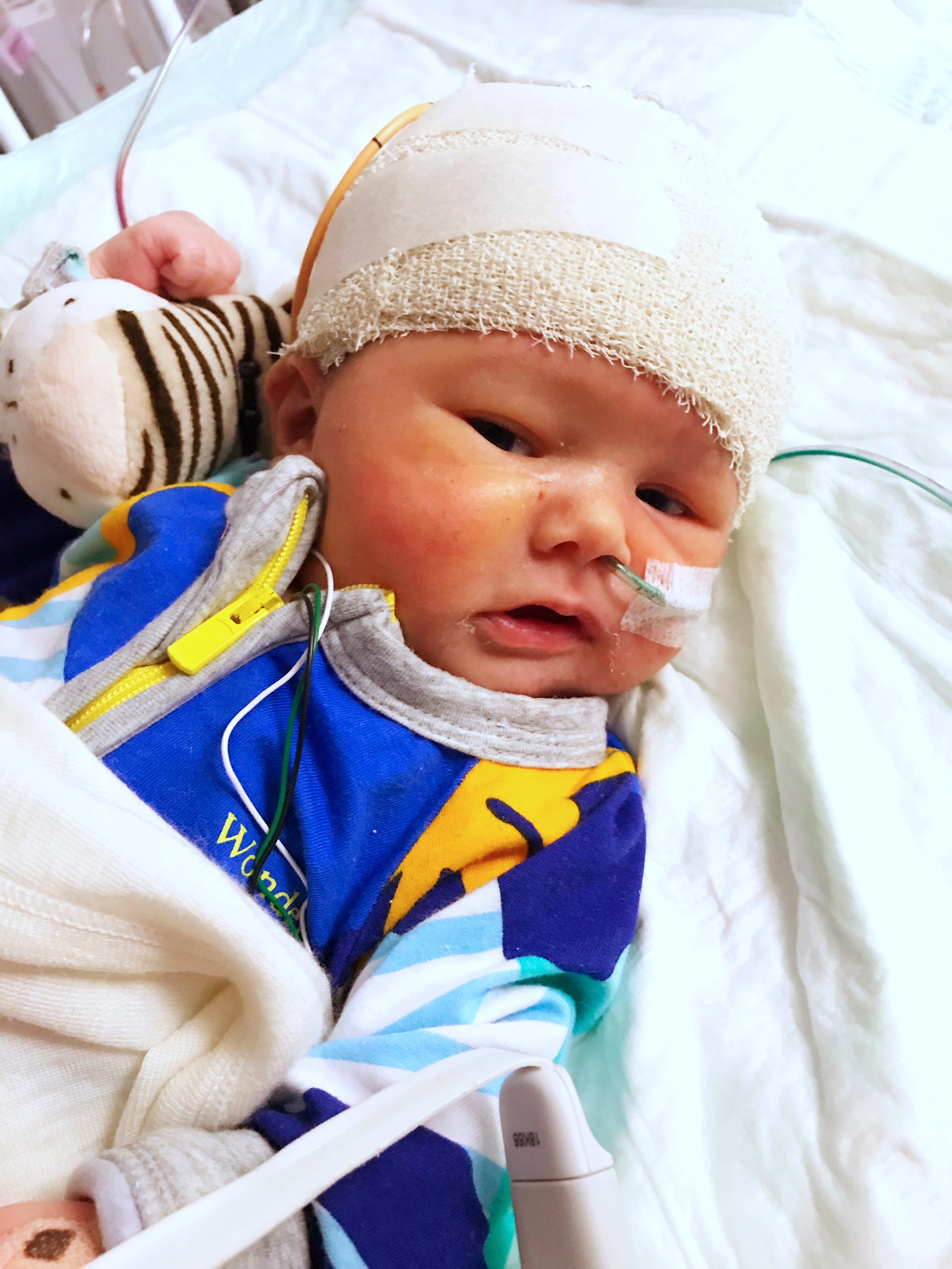 Kaden Brown at 6 days old in Auckland's Starship Hospital. After suffering a brain-bleed injury at birth, he was diagnosed with hydrocephalus, a neurological disorder that causes a dangerous build-up of fluid in his brain.
