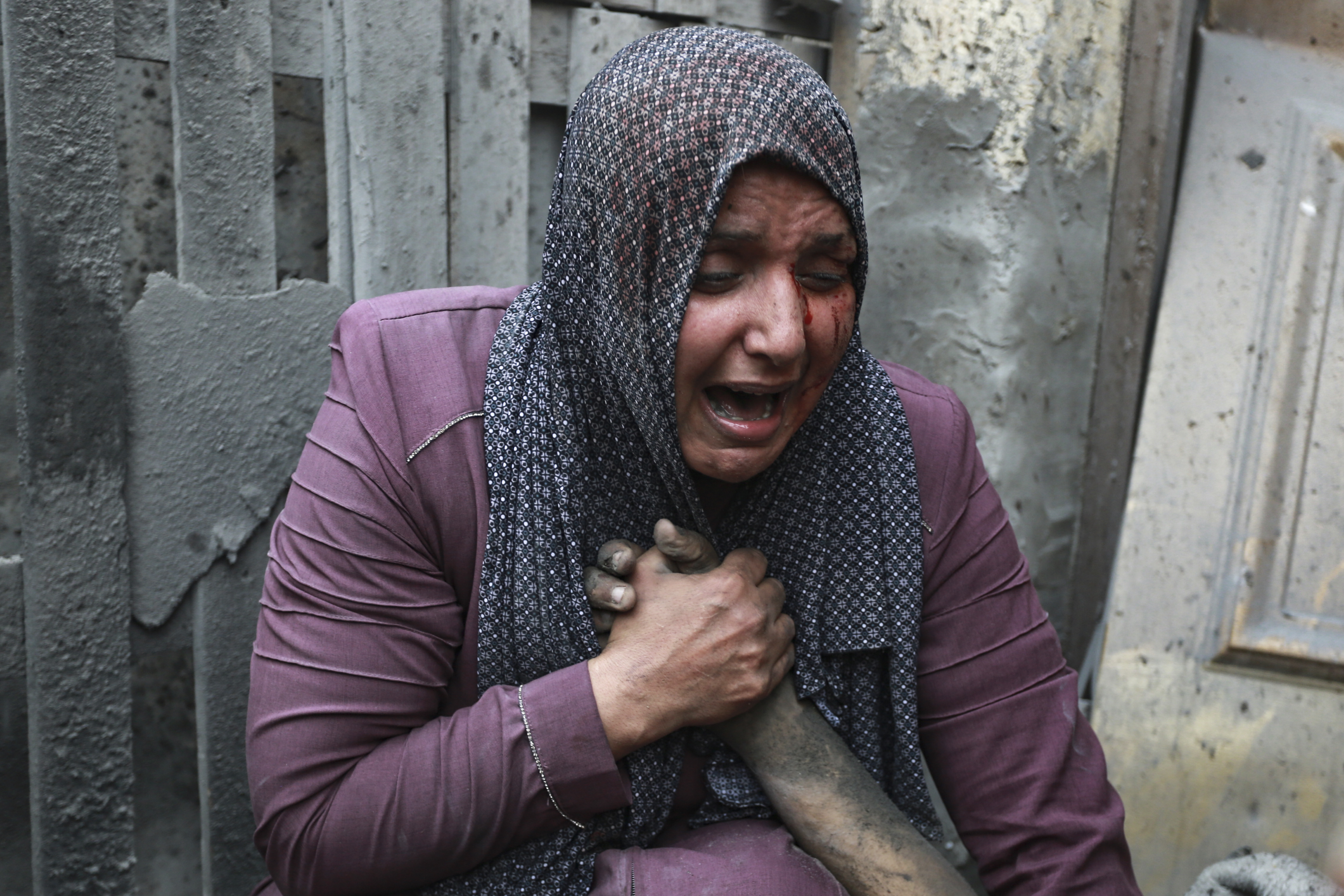 A wounded Palestinian woman cries as she holds the hand of her dead relative outside her home following Israeli airstrikes. Photo / AP
