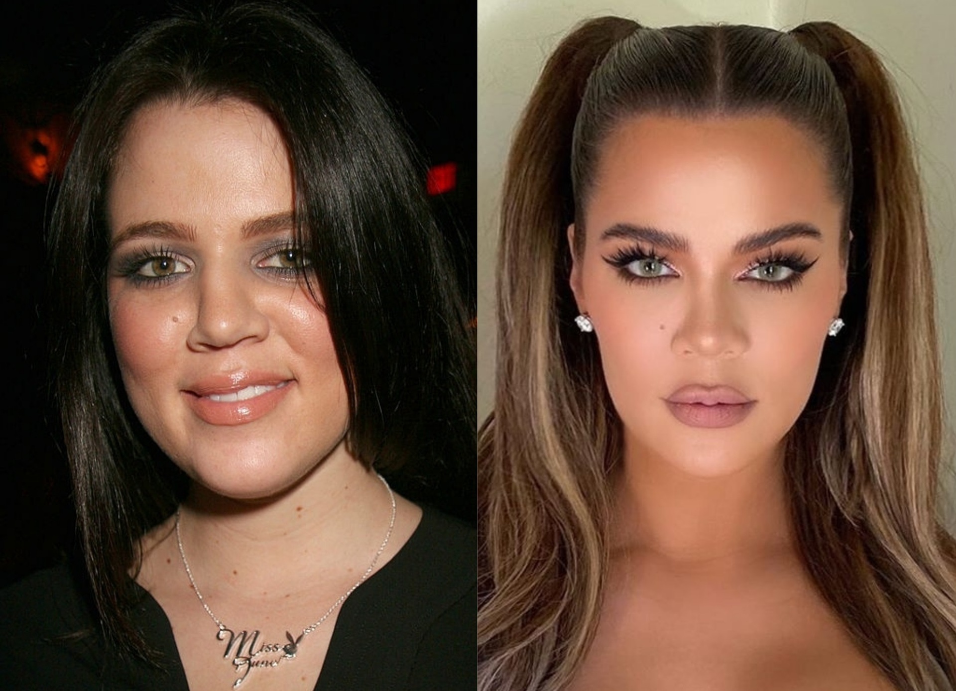 Khloe Kardashian&#39;s plastic surgery secrets revealed - NZ Herald