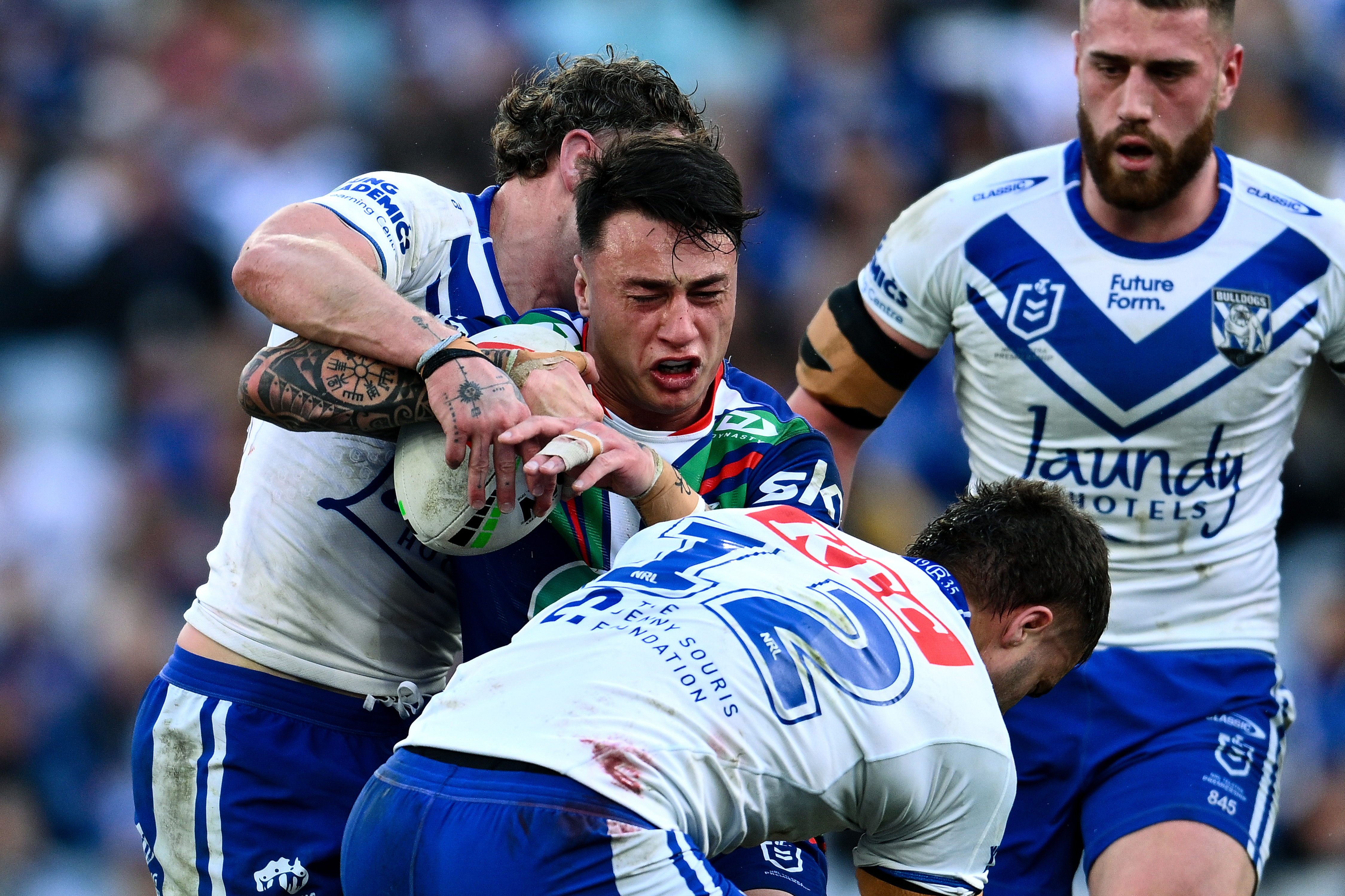 Charnze Nicoll-Klokstad suffered a calf injury against the Bulldogs. Photo / Photosport
