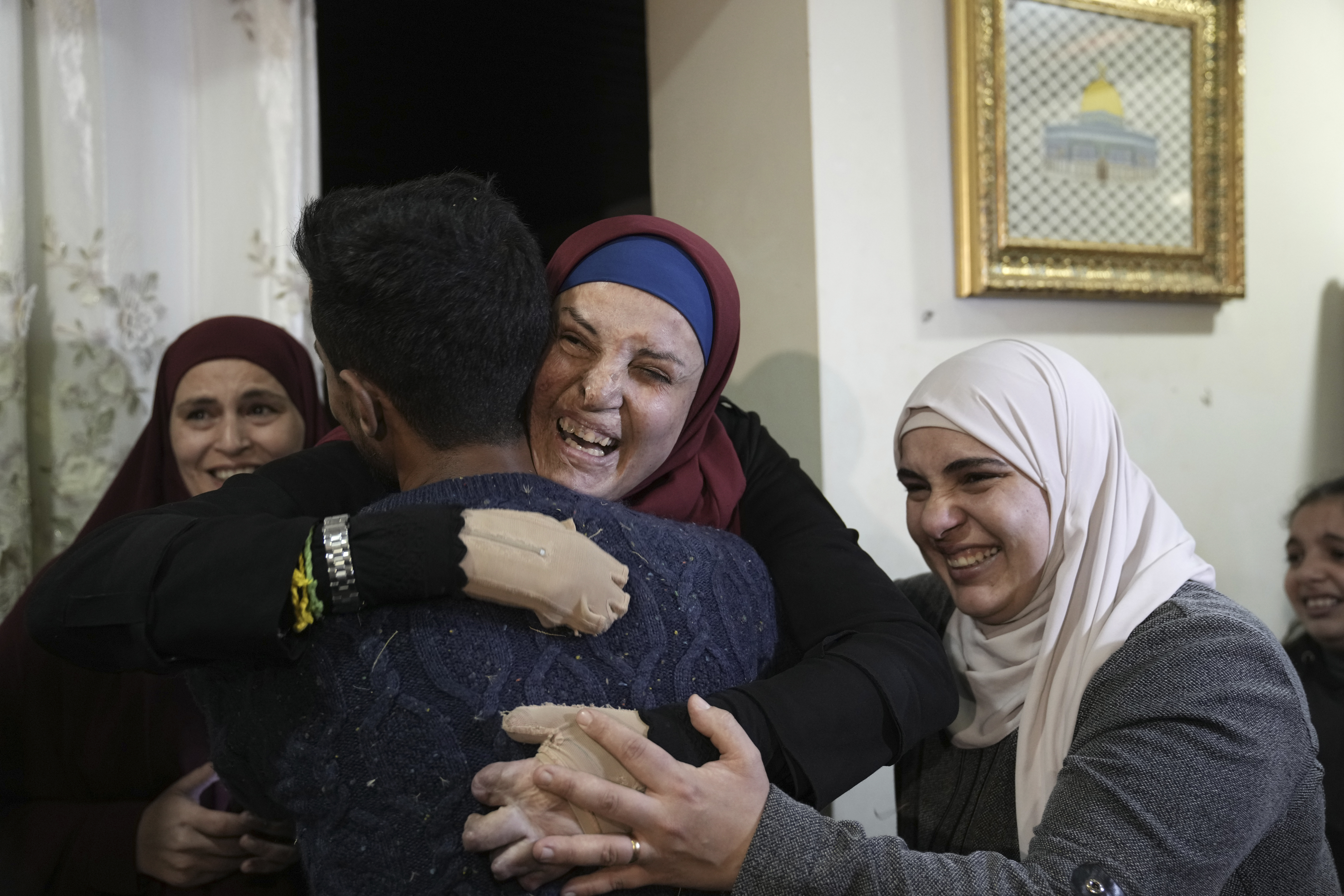 Israa Jaabis, centre, a Palestinian prisoner released by Israel, is hugged by relatives as she arrives home in the east Jerusalem neighbourhood of Jabel Mukaber. Photo / AP