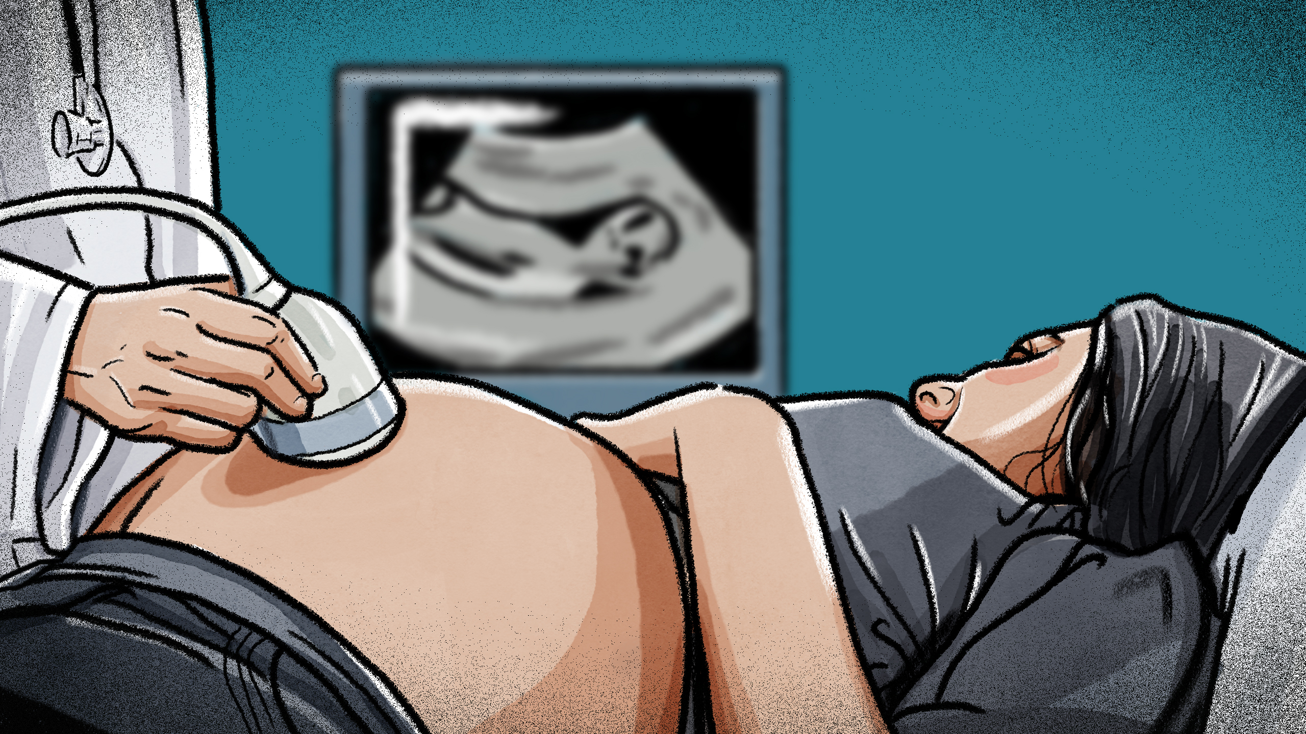 The 20-week anatomy scan revealed Harshey's baby had a severe disability. Image / Paul Slater