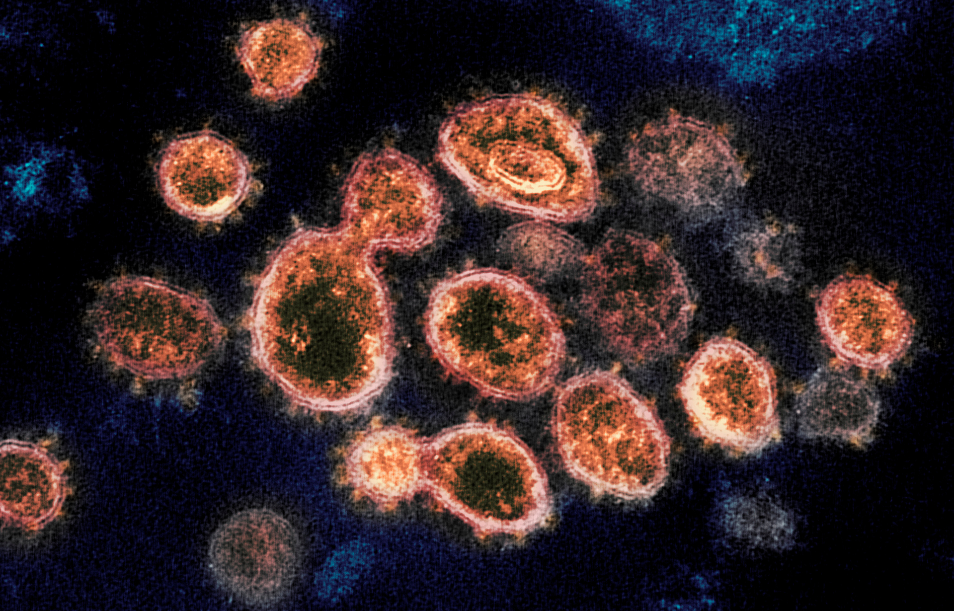 Kiwi scientists have designed a new way to unravel the genomic origins of Covid-19 cases, which could shed fresh light on the mystery source of Auckland's August outbreak. Photo / AP