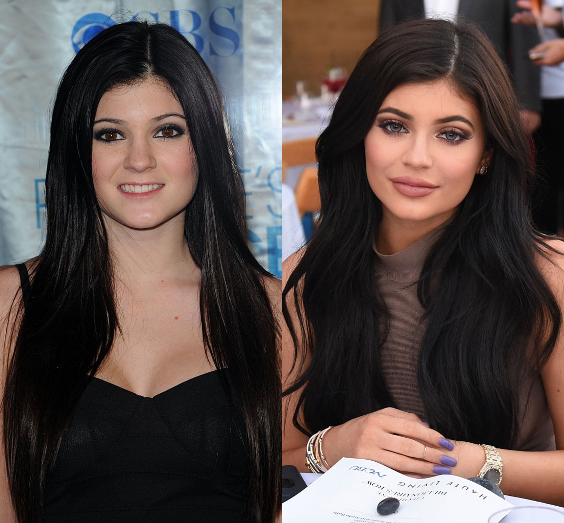 Kylie jenner before plastic surgery you can find fascinating photos! 