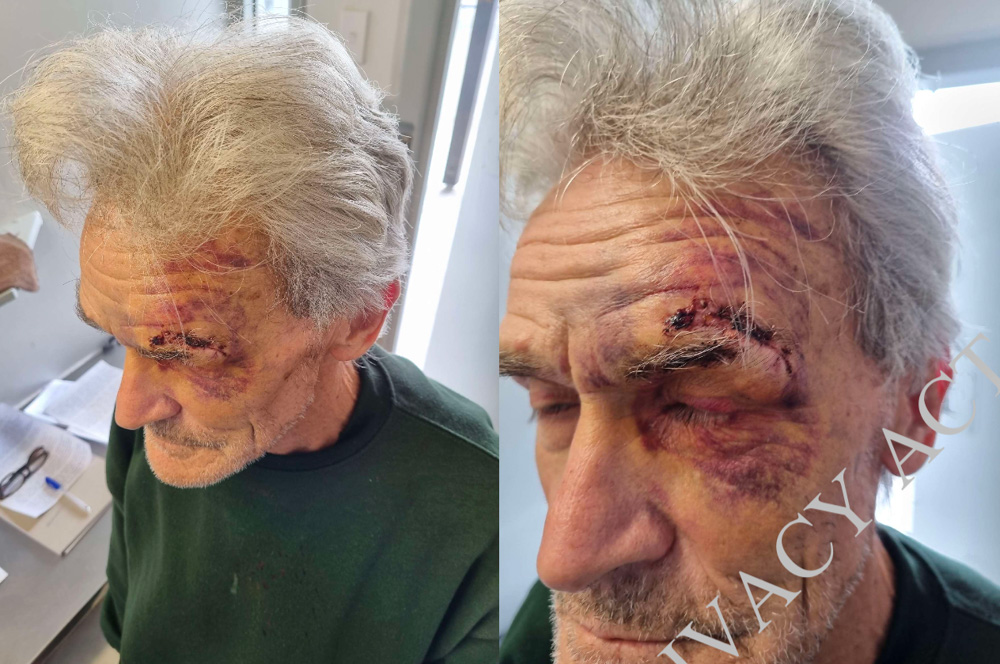 Dean Wickliffe claims he was assaulted in Springhill prison by guards. Photo / Dean Wickliffe