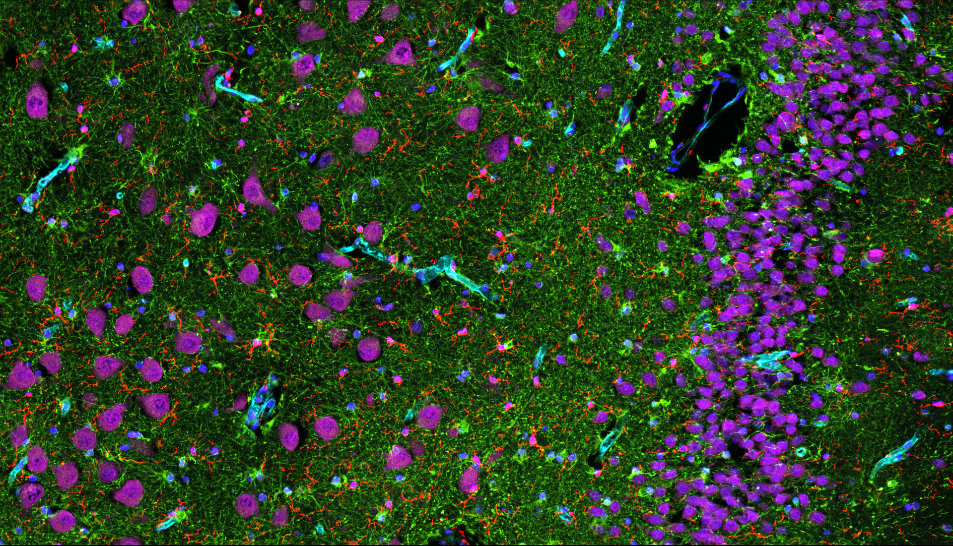 A microscopic image of brain tissue cells.