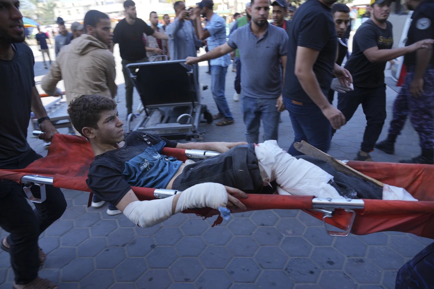 A Palestinian wounded in Israeli bombardment is brought to a hospital in Deir al-Balah, south of the Gaza Strip. Photo / AP