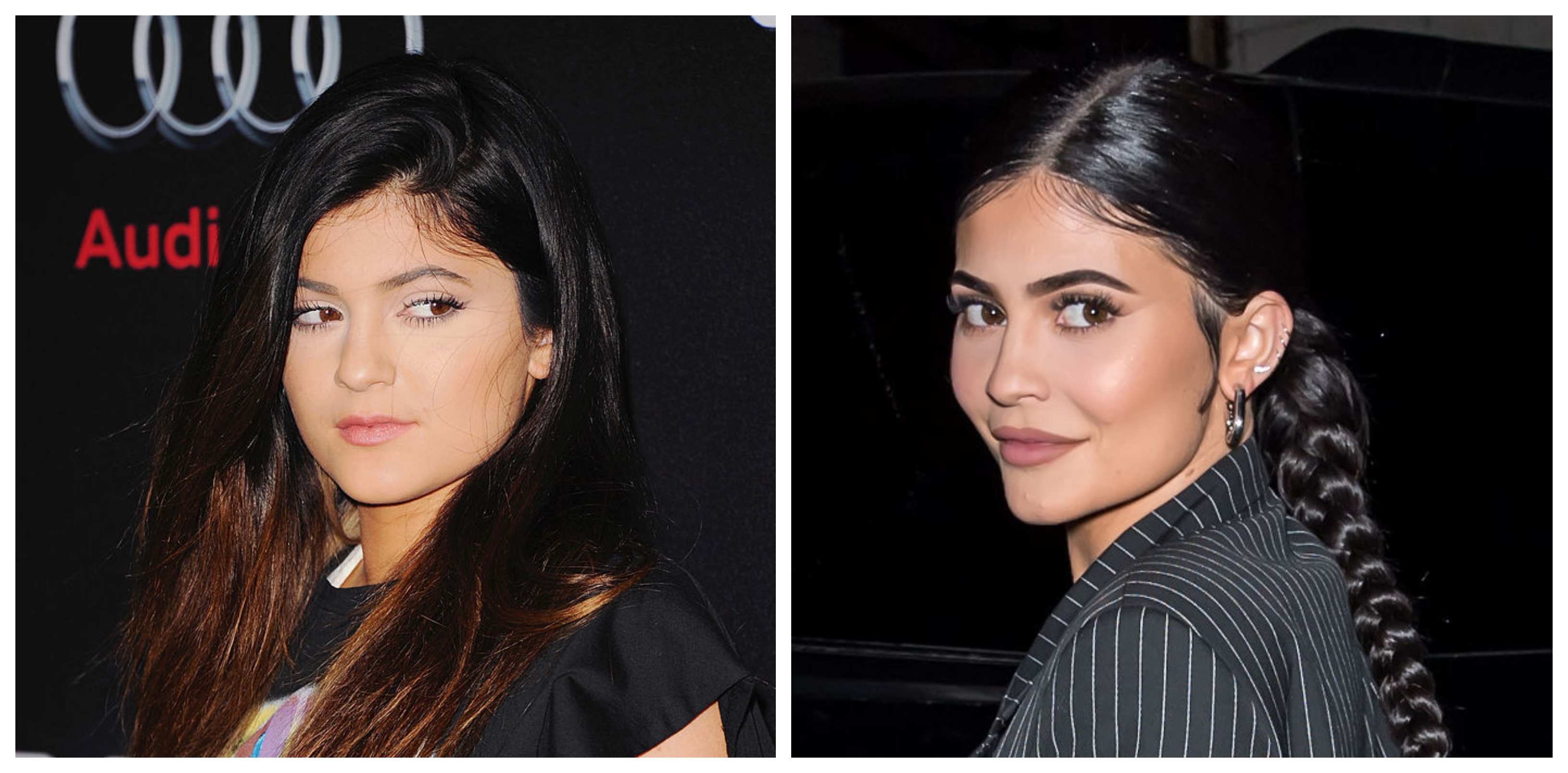 Kylie Jenner sparked an interest in a certain look when she began using filler back in 2014. Photos / Getty Images