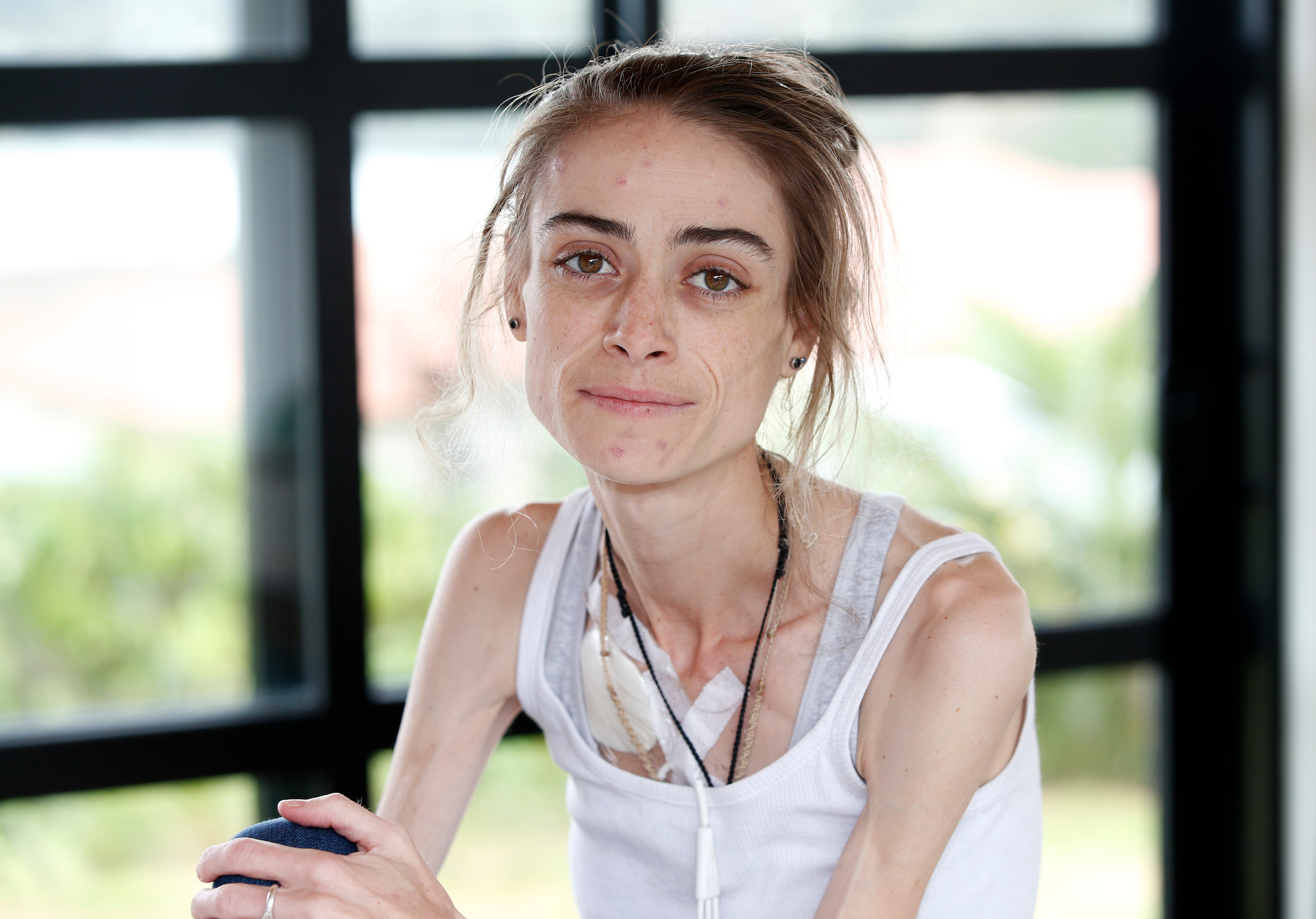 Ruby Hill died battling a debilitating digestive condition that caused her body to waste away. Photo / Michael Cunningham