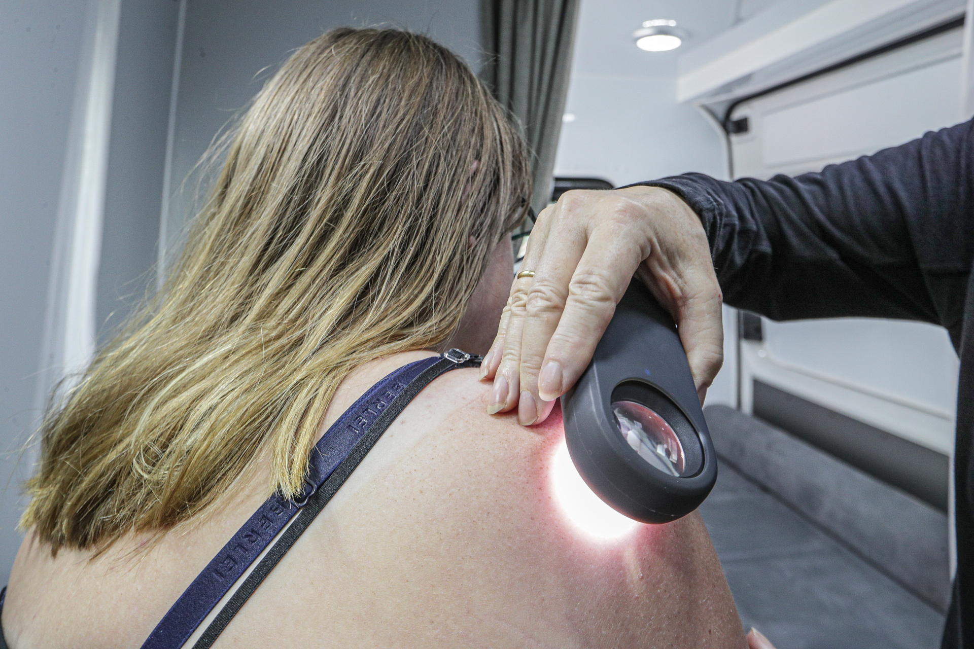 New Zealand had the world's highest death rate from melanoma in 2020, say researchers. Photo / Warren Buckland