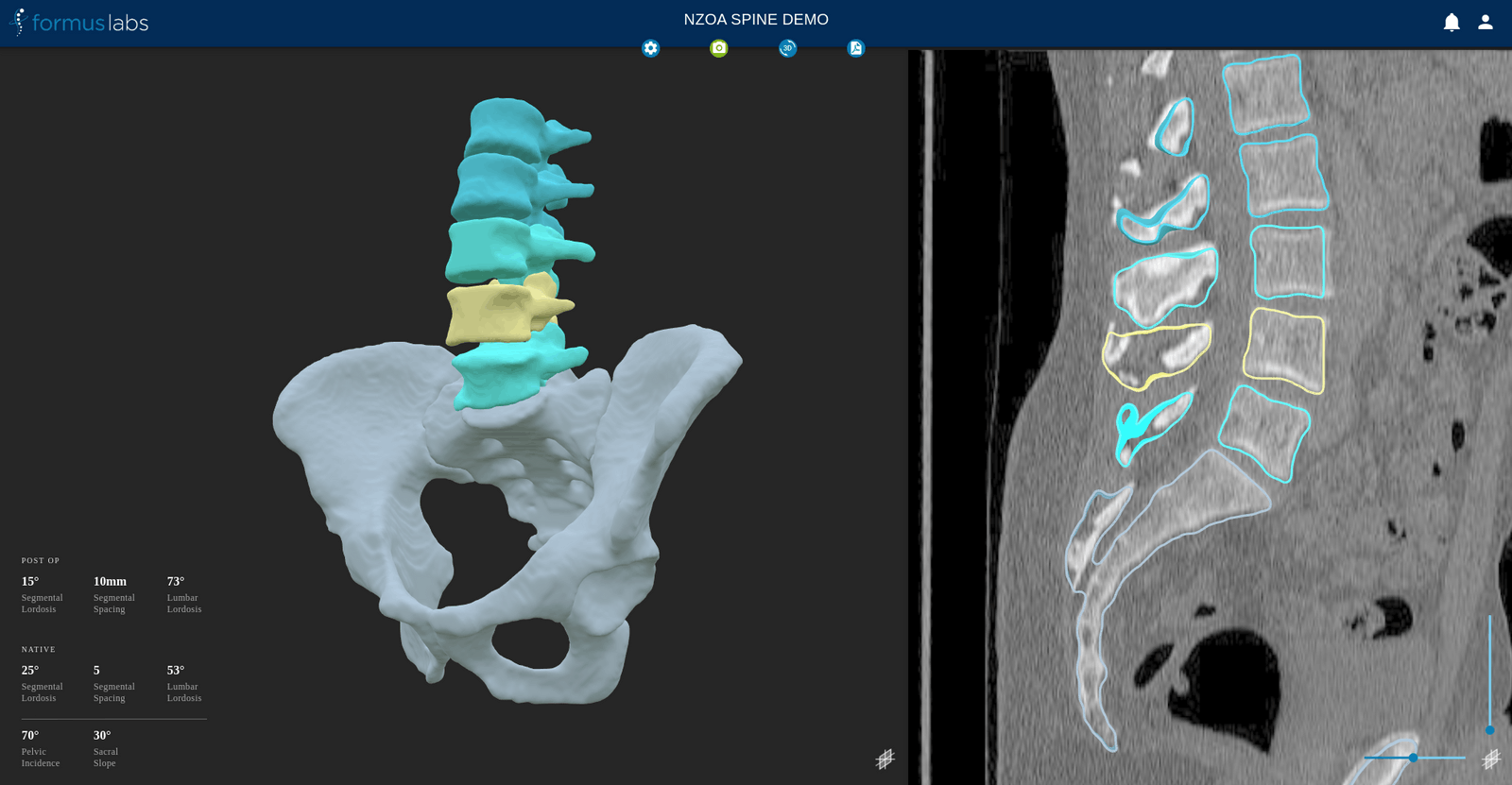  Formus Spine - 