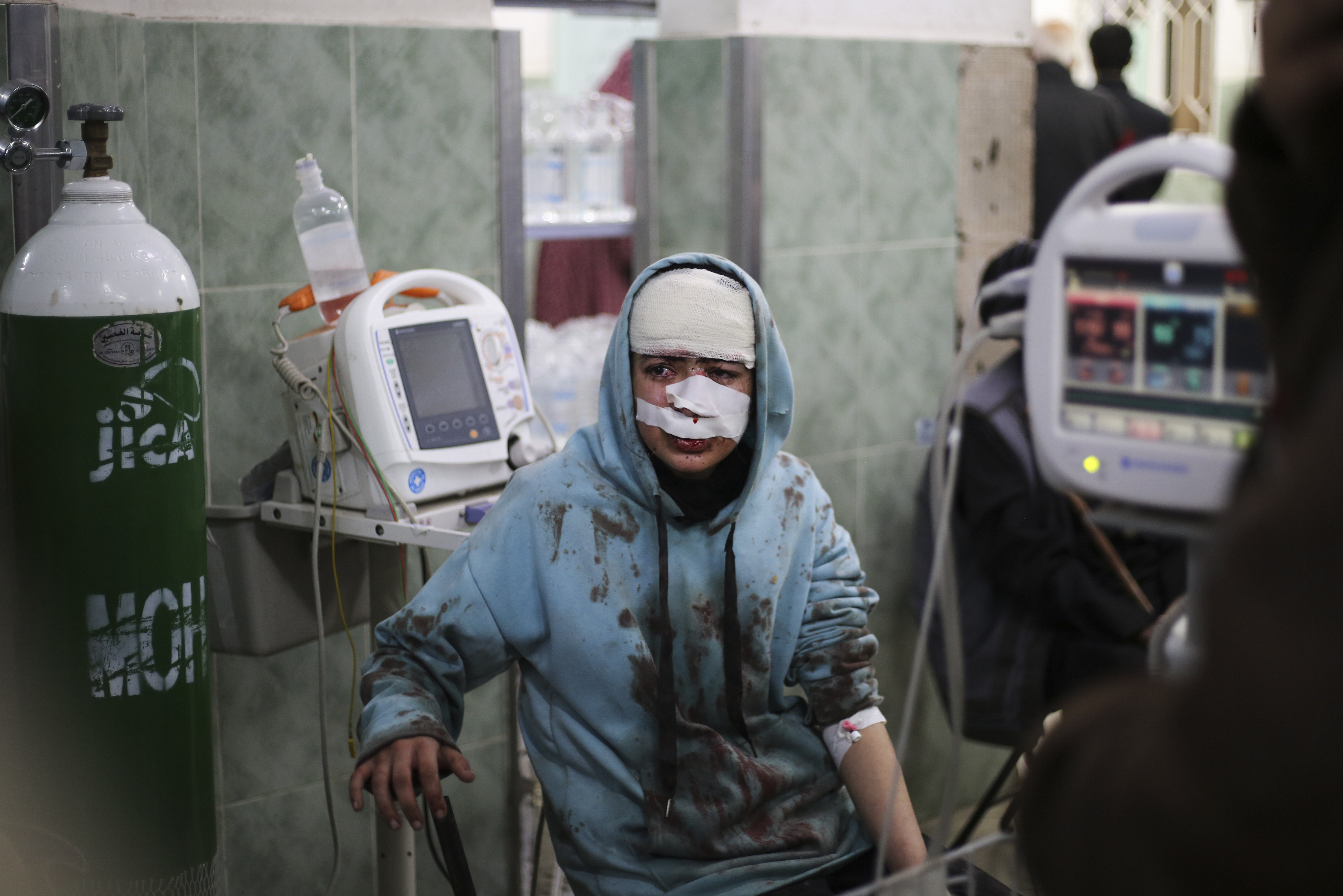 A Palestinian wounded in the Israeli bombardment sits in a hospital In Rafah, Gaza Strip. Photo / AP