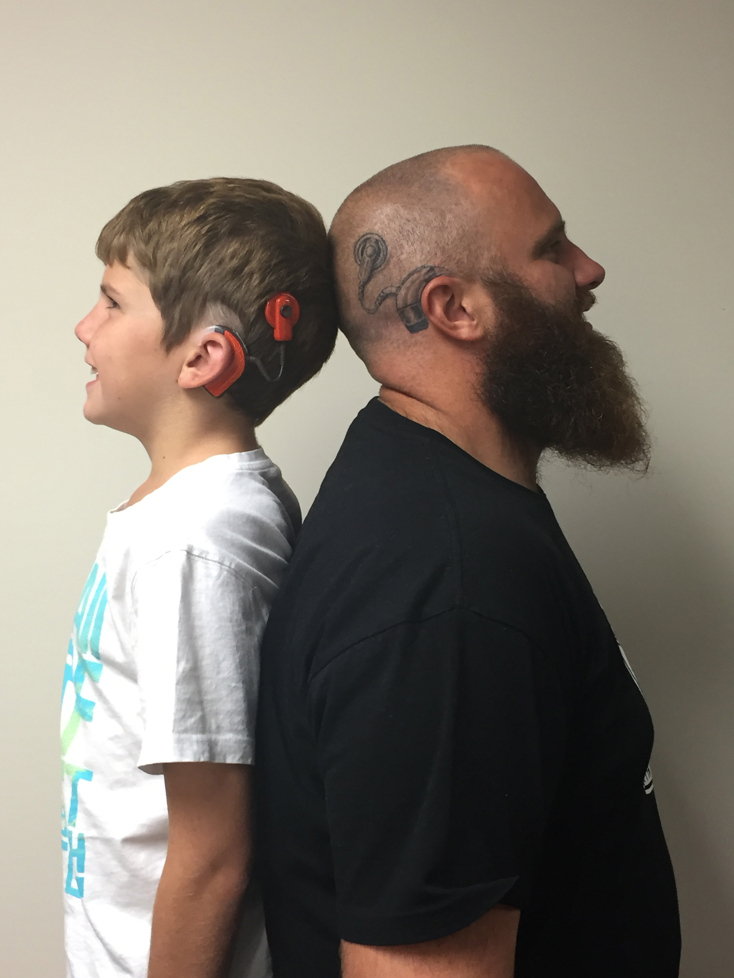 Irish dad gets a tattoo of sons cochlear implant Viral video will make  you emotional  India Today