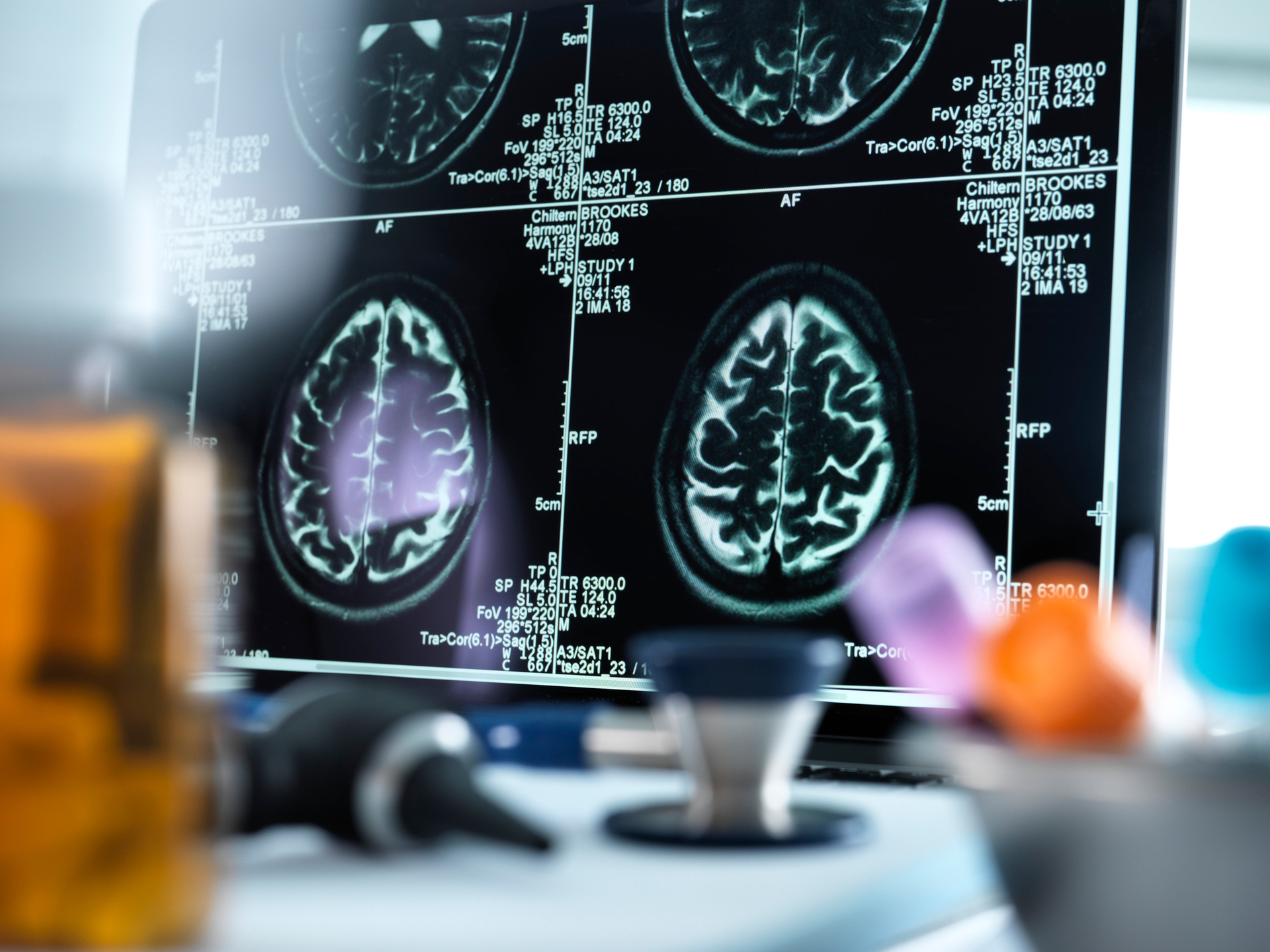 Magnetic resonance imaging (MRI) brain scans displayed on a screen on a doctor's desk.