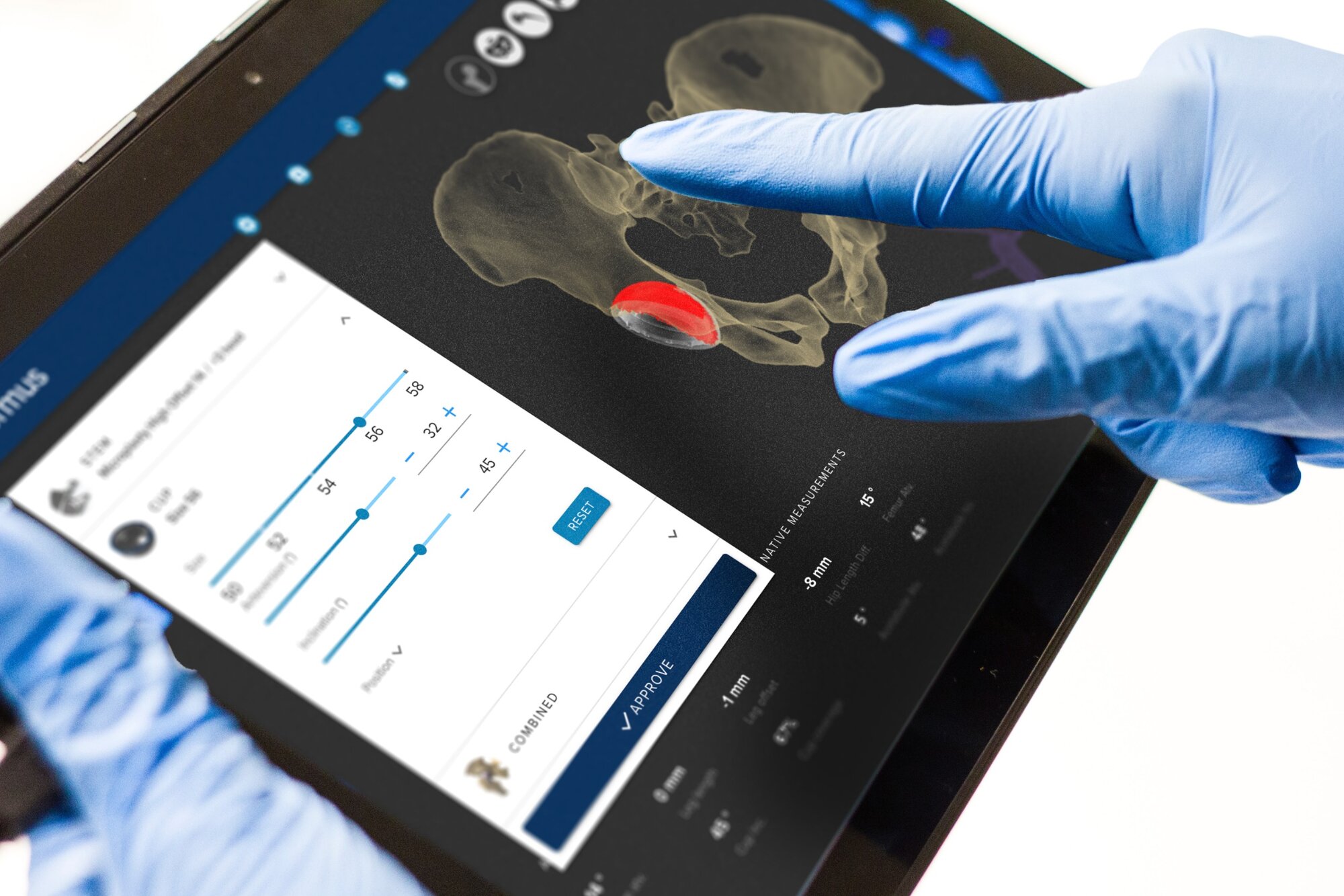  Formus Labs' AI-powered, 3D planning software for joint replacement surgeries. Photo / Supplied