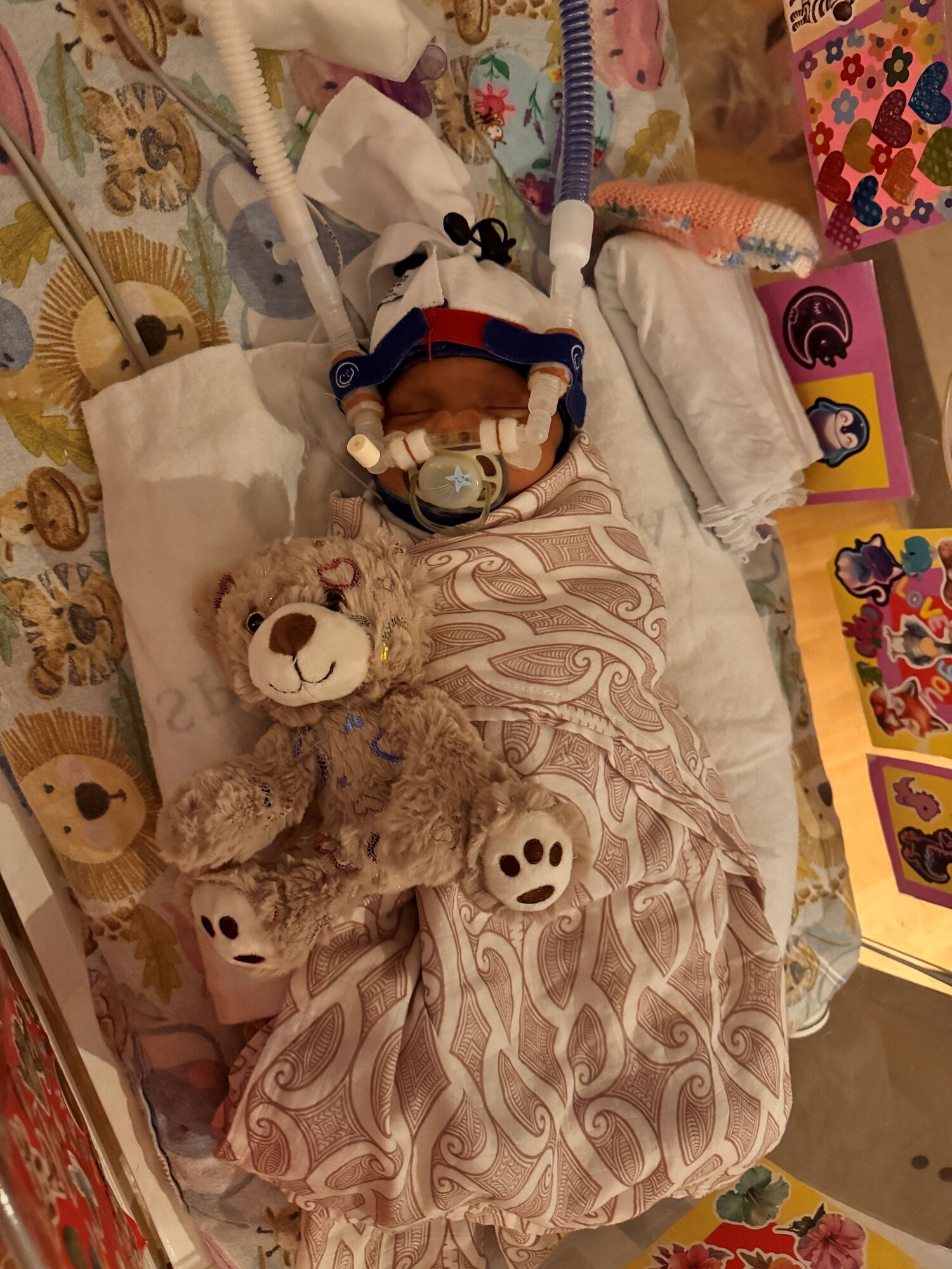 Sophie Neho started her life needing a ventilator, before moving on to a CPAP (continuous positive airway pressure) machine (pictured). She's since improved further and is now receiving oxygen at a high flow rate, which is sometimes varied to a low flow. 