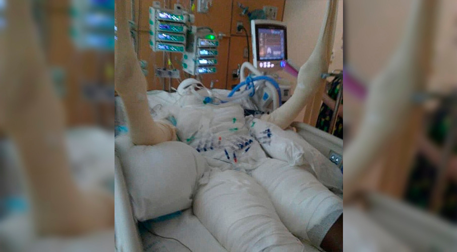 The victim is in the hospital with burns to half of her body after setting herself on fire on Friday as part of the 'Fire Challenge'. Photo / Facebook