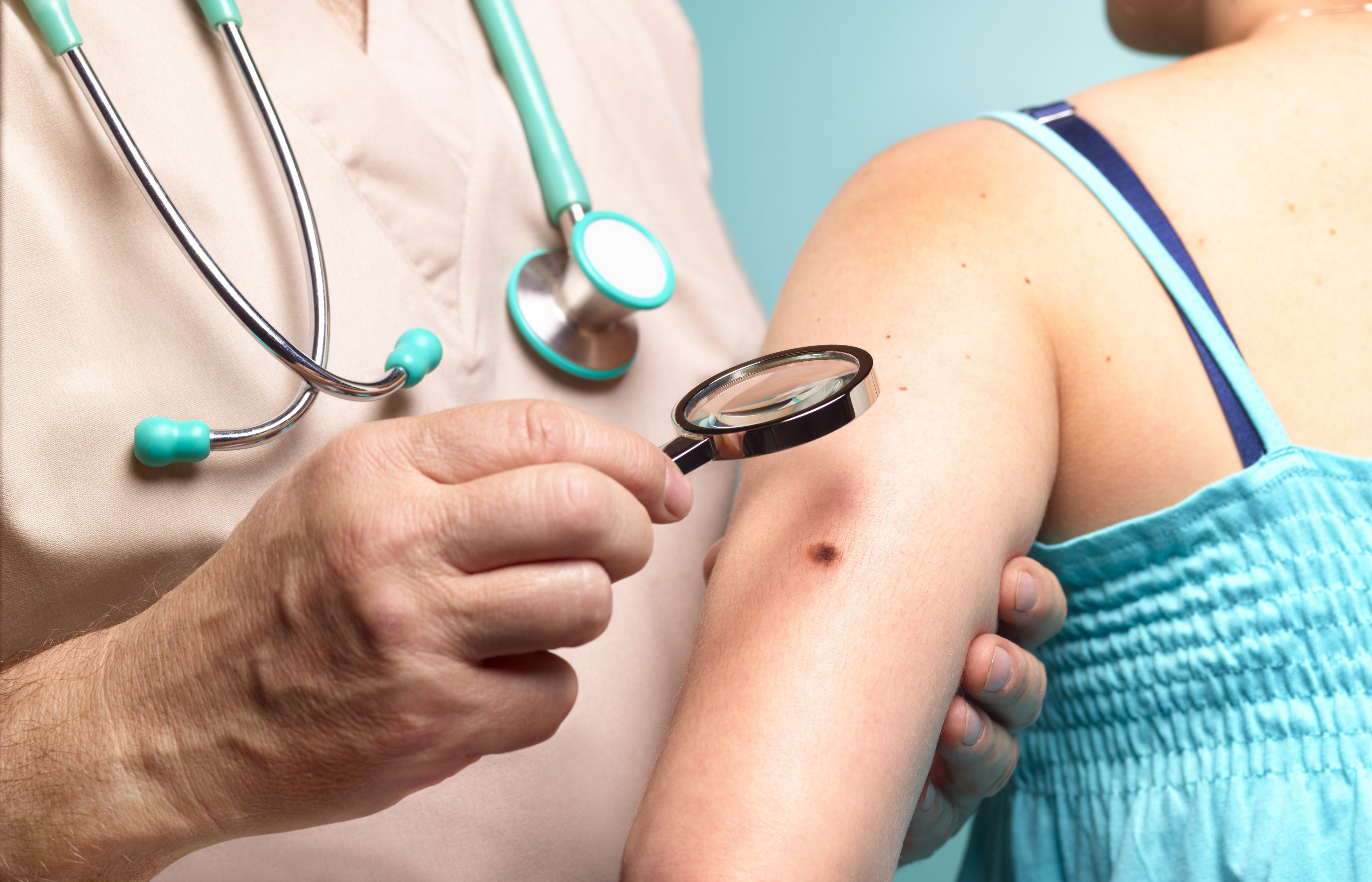 Rates of melanoma skin cancer have more than doubled in the UK over the past 30 years. Photo / Getty Images