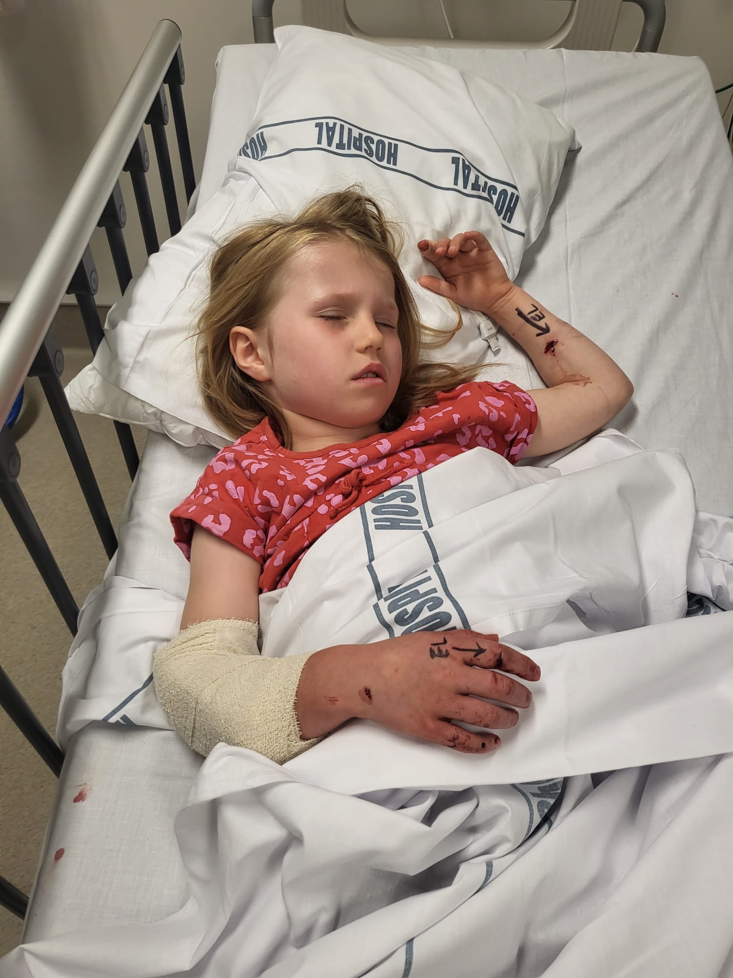 Sienna Lewis, 6, in Tauranga Hospital after she was attacked by a dog. Photo / Supplied