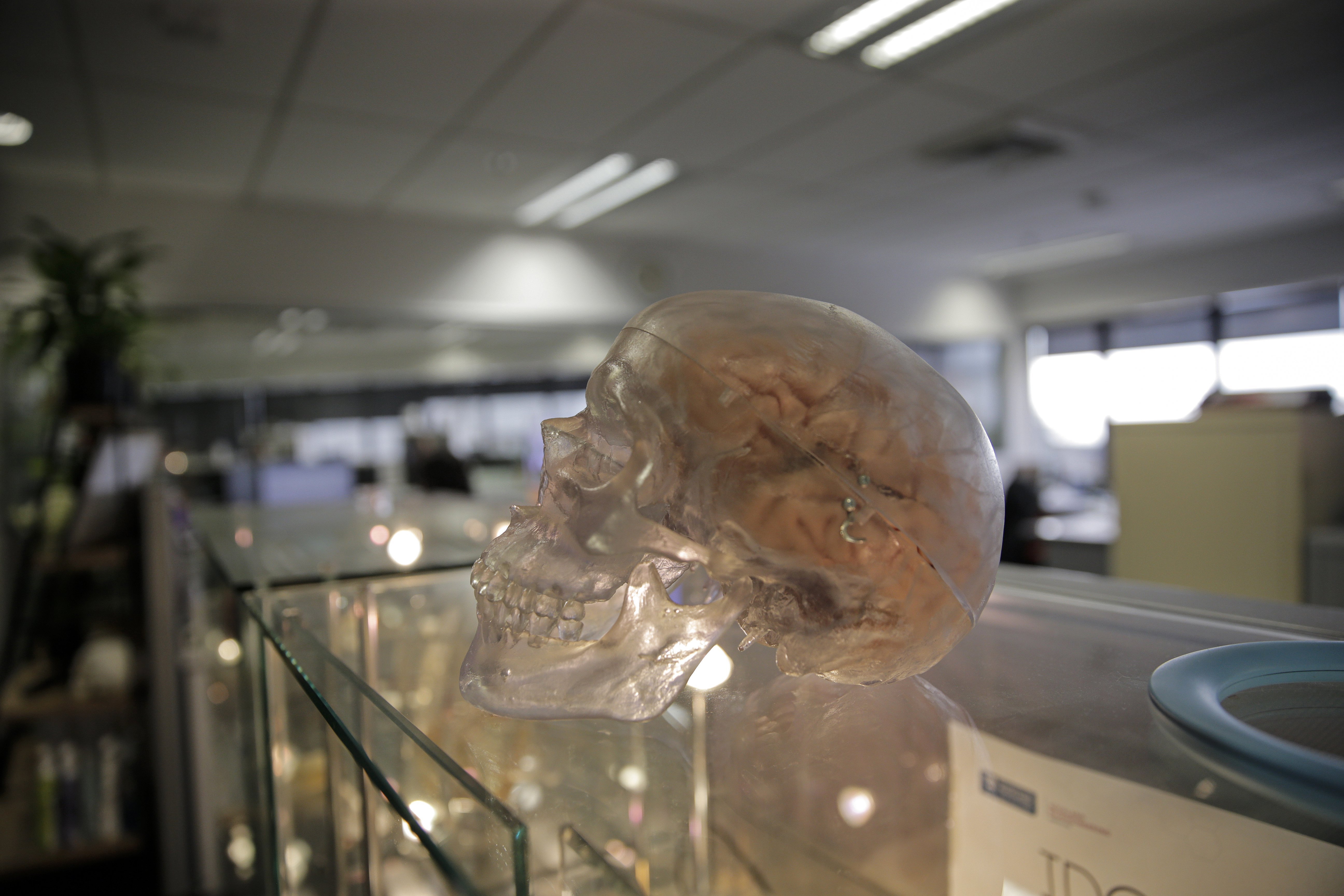Kitea Health's sensor chip is 20mm long by 2mm deep by 3mm wide, and weighs  0.3 grams. It is implanted into the skull next to the drainage shunt when the shunt is replaced or when it is inserted for the first time. Photo / Alex Burton 