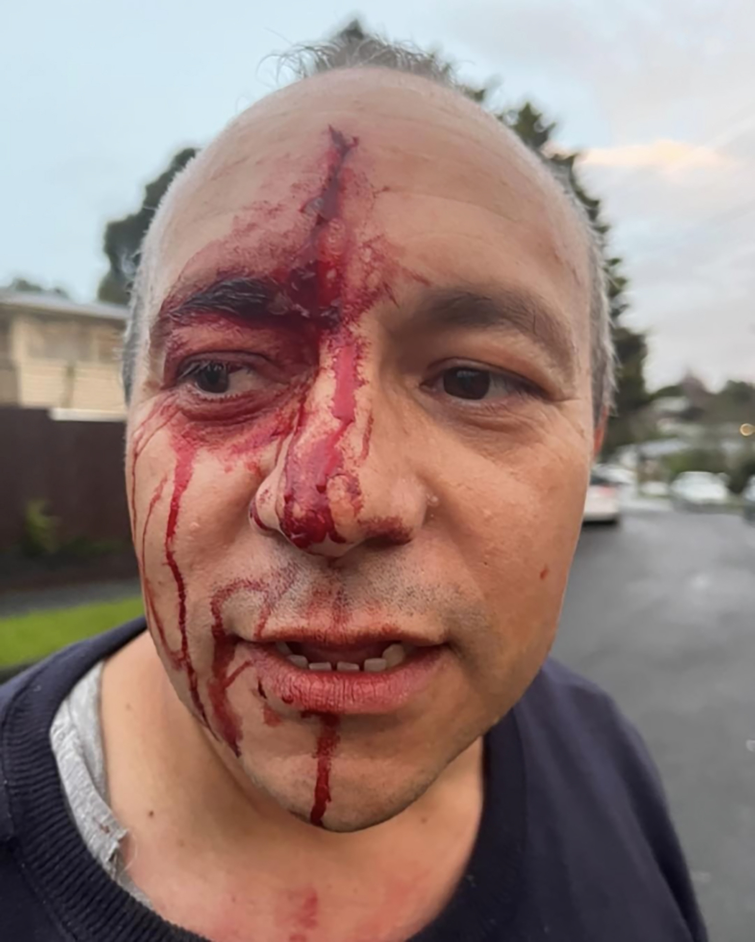 Auckland mayoral candidate Craig Lord and his son went to hospital with minor injuries after an altercation with an alleged drink driver. Photo / Supplied