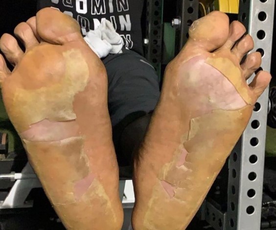 Barber: Antonio Brown's feet are holding Raiders back