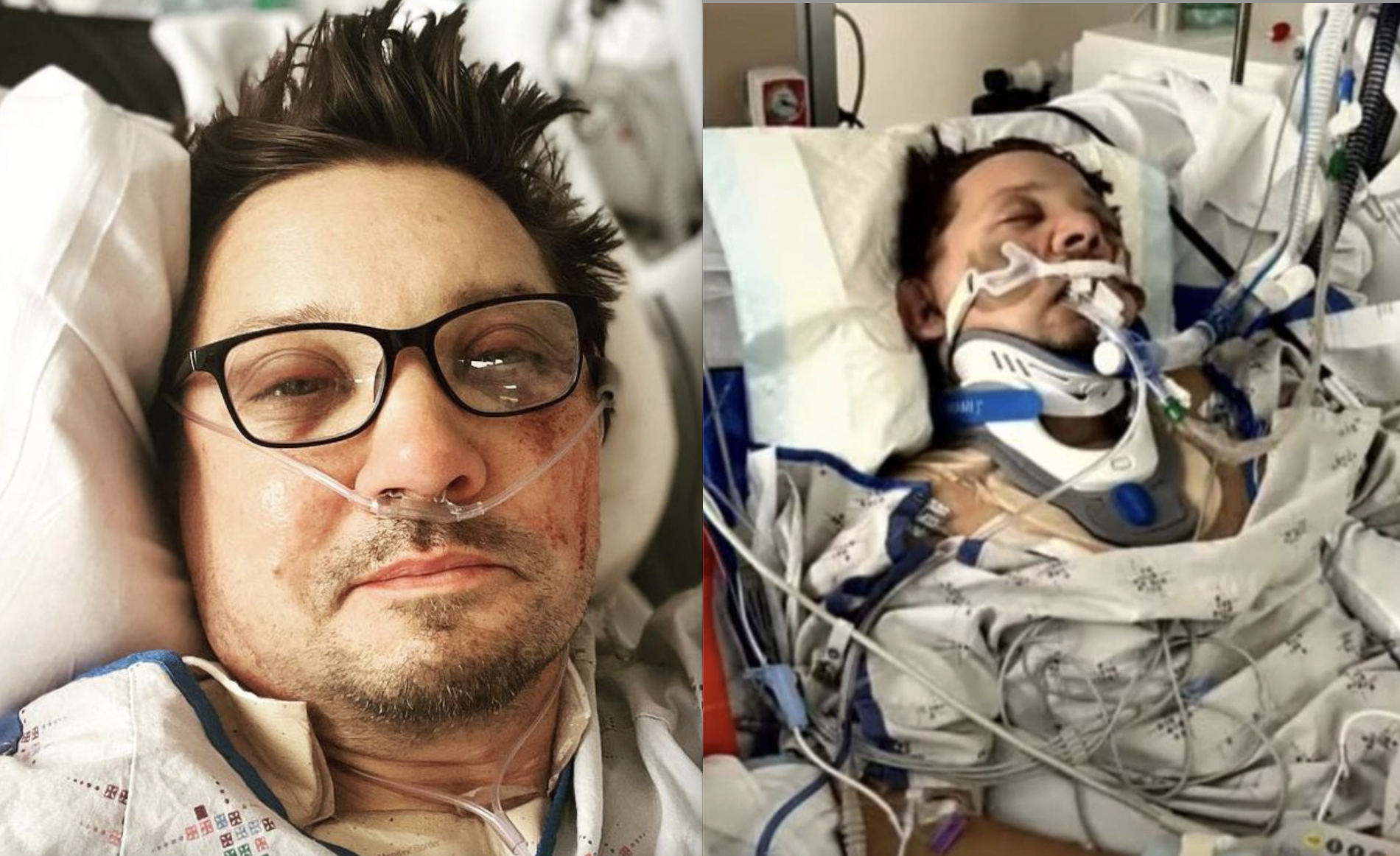 Jeremy Renner suffered 38 broken bones and a collapsed lung after being run over by a snowplough in January last year. Photo / ABC