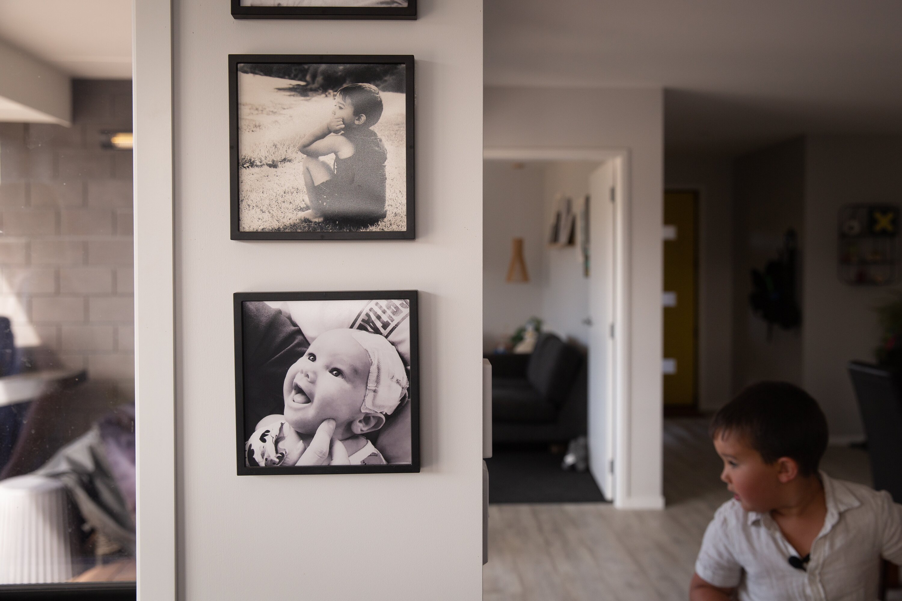 Photos on the wall of Kaden's home track his remarkable progress, from multiple brain surgeries in the first weeks of his life to the active schoolboy he is today. Photo / Sylvie Whinray