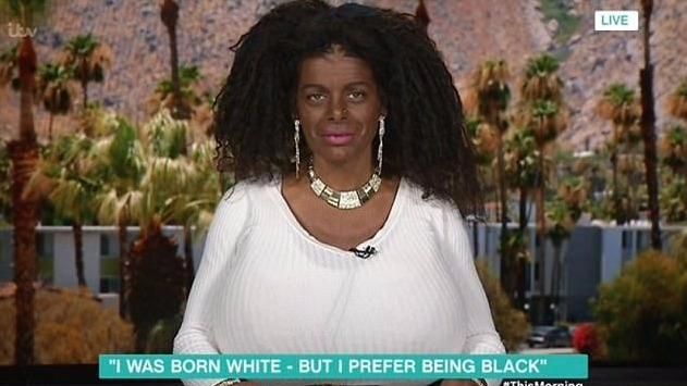 white lady turned black with melanotan Why shouldn't this German woman 'identify as black'? Woman who dyed her skin