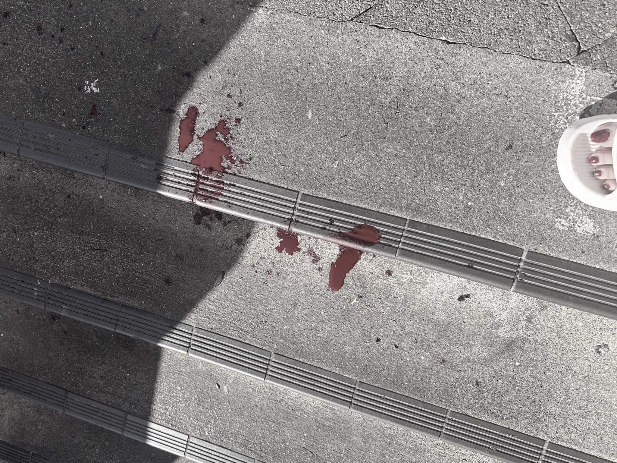 The girl's blood was splattered on the ground after the incident. Photo / Supplied