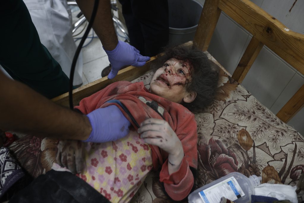 A Palestinian child wounded in the Israeli bombardment of the Gaza Strip is treated at a hospital in Khan Younis. Photo / AP