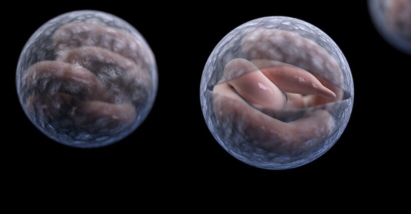 Cryptosporidiosis is a disease caused by a microscopic parasite called cryptosporidium. Image / CDC