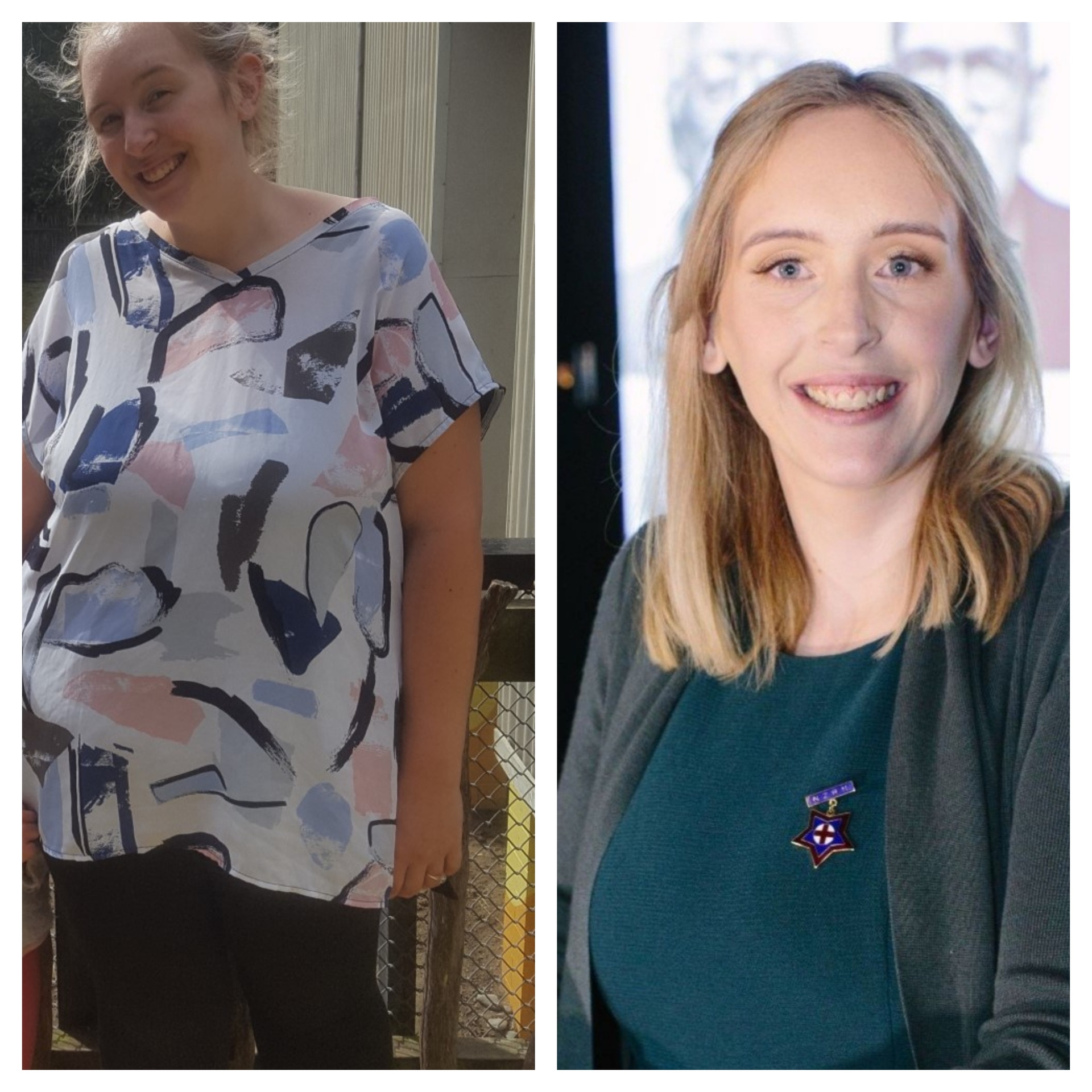 Lauren Peat says since her bariatric surgery she has had significantly less flare ups with her Multiple Sclerosis. Photos / Supplied