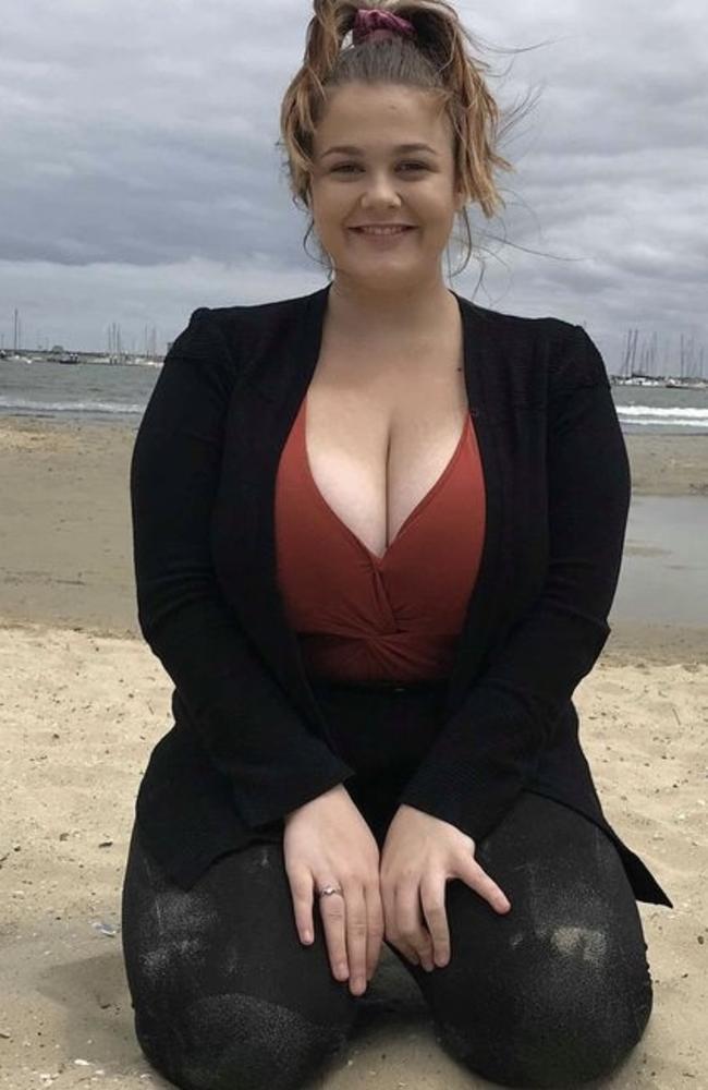 Melbourne woman was being 'crushed' by her size JJ breasts at 21 - NZ Herald