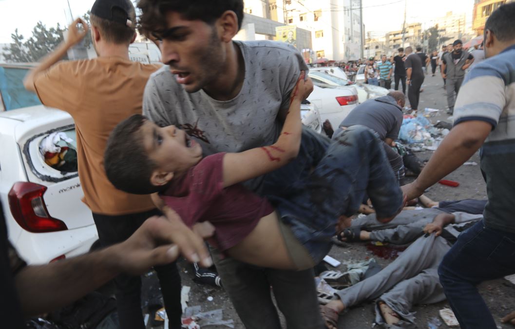 An injured Palestinian boy is carried from the ground following an Israeli airstrike outside the entrance of the al-Shifa hospital. Photo / AP