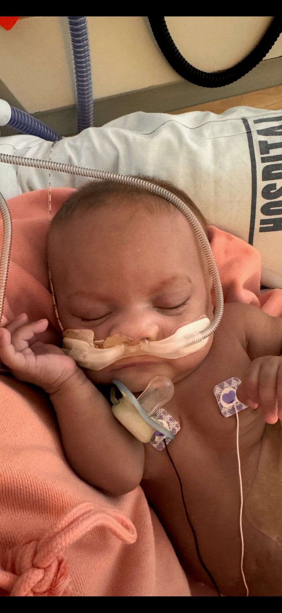 Sophie Neho has pulmonary vein stenosis (PVS), a rare condition where the veins that carry blood from the lungs back to the heart are narrowed.