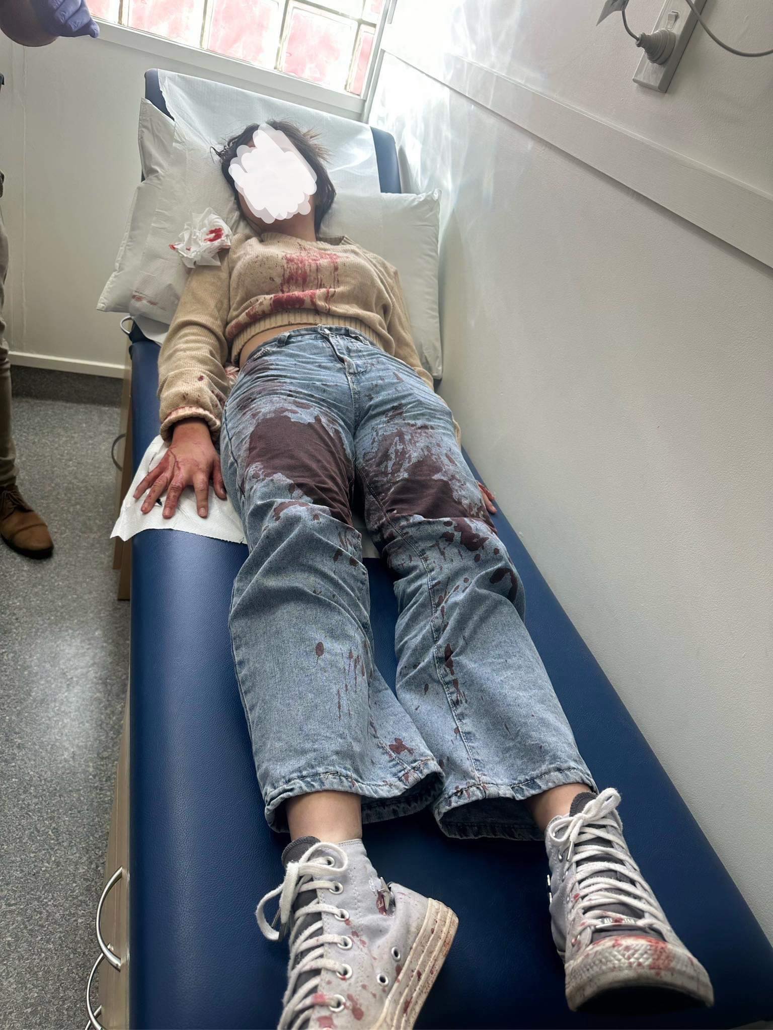 The 12-year-old girl was left covered in blood after being assaulted outside McDonald's Glenfield. Photo / Supplied