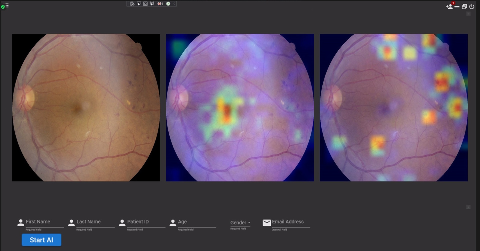 Toku Eyes' THEIA software uses artificial intelligence to analyse a retinal image then return a result in around 10 seconds. Image / Supplied