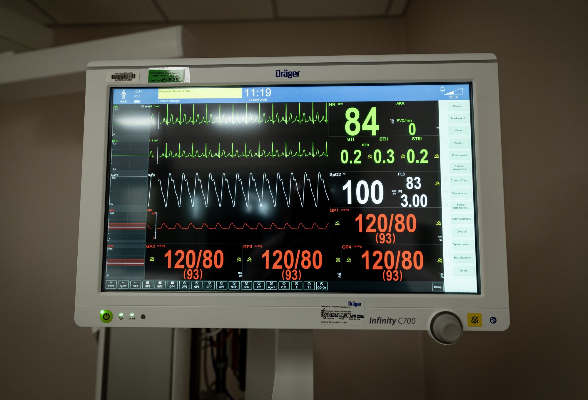 Inside the new six-bed intensive care unit at the Gilgit Wing. Photo / Dean Purcell