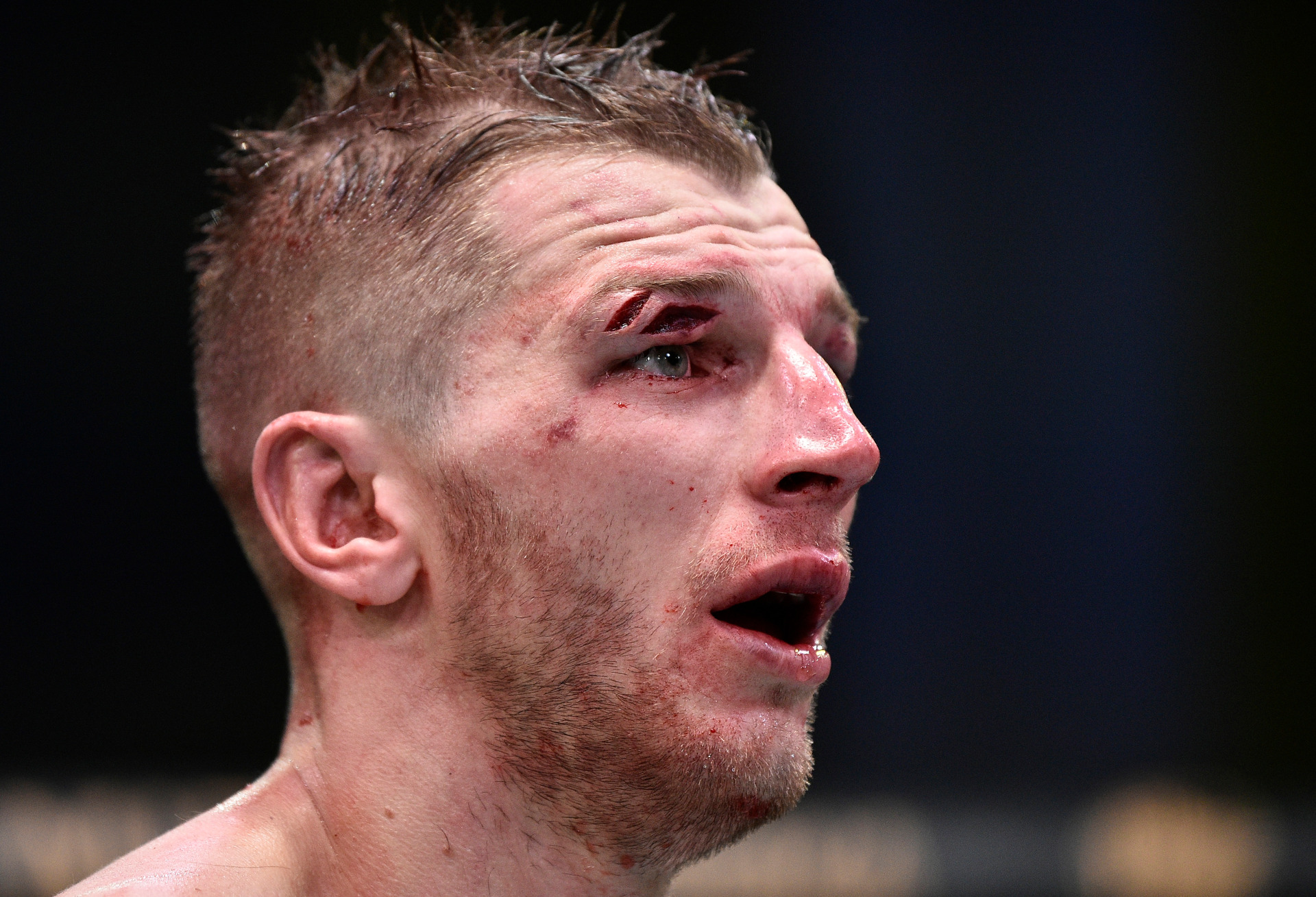 Dan Hooker was cut above his right eye during his fight with Dustin Poirier. Photo / Getty Images