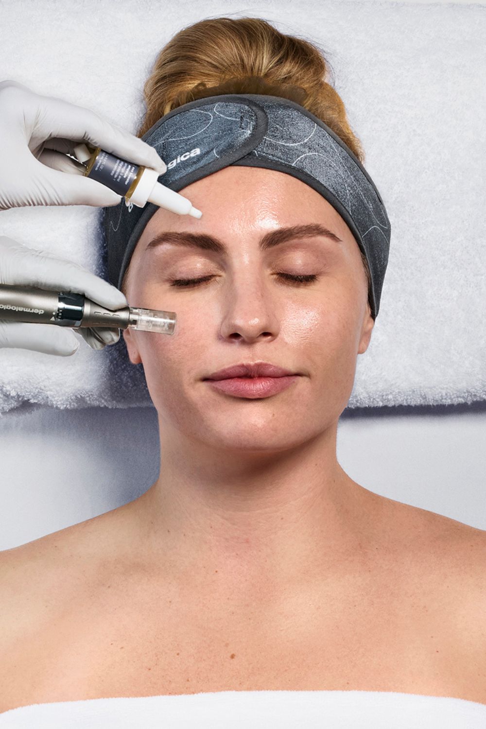 Are exosomes the next big thing in beauty? This new skin treatment combines exosome therapy with microneedling to boost results. Photo / Supplied 