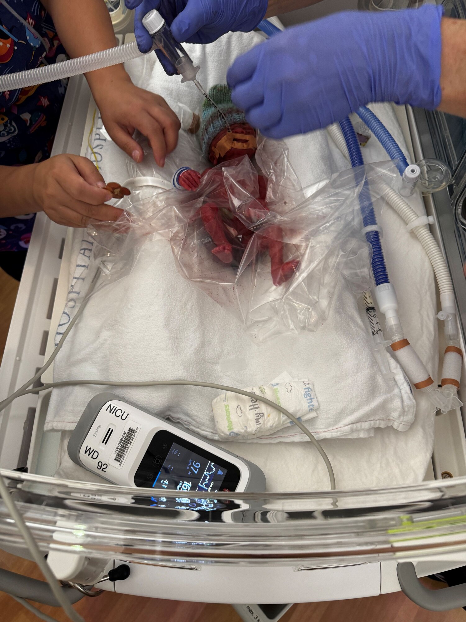 Sophie Neho pictured soon after her birth at 24 weeks and two days' gestation on April 9. 