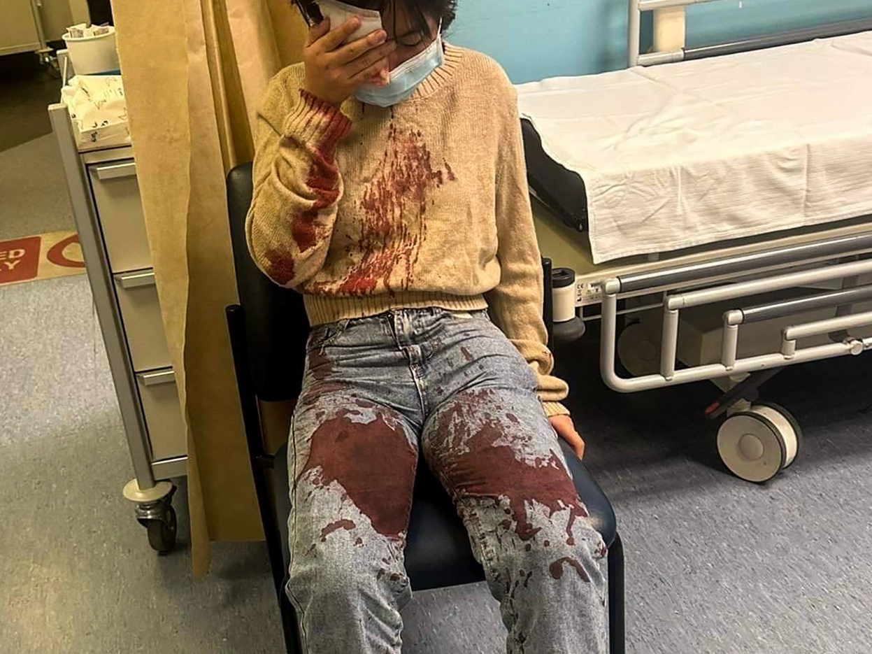 An arrest has been made after a 12-year-old girl was beaten on the steps outside a McDonald's restaurant in Glenfield on Auckland's North Shore. Photo / Supplied