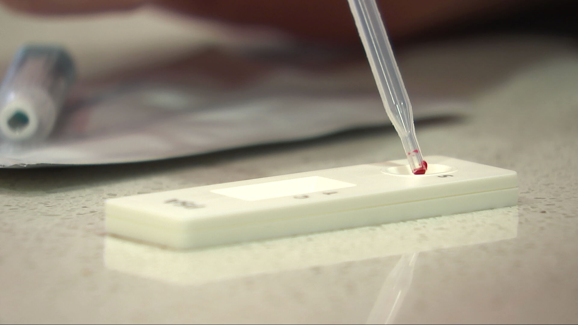 Prostate cancer blood test.