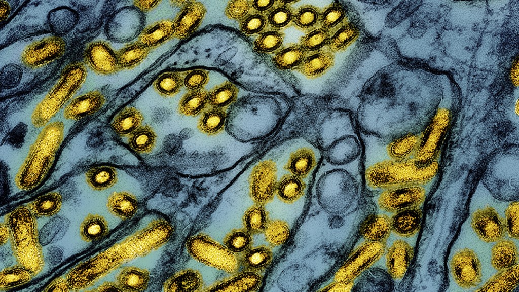 This colourised electron microscope image shows avian influenza A H5N1 virus particles (yellow), grown in Madin-Darby Canine Kidney (MDCK) epithelial cells (blue).